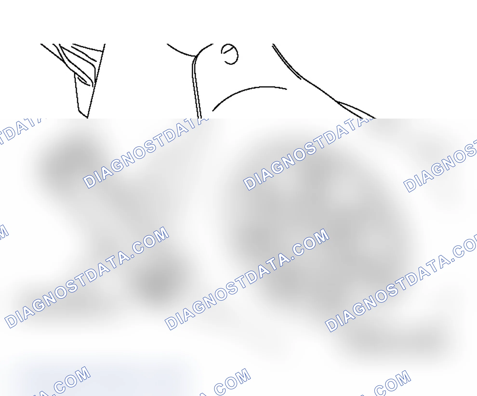 Scheme 380: << B >>CAMSHAFT POSITION SENSING CYLINDER REMOVAL