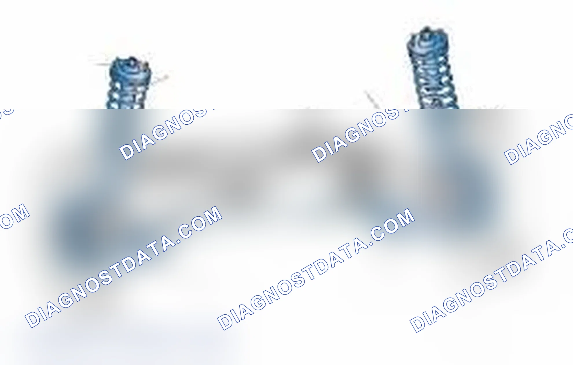 Scheme 25: Typical Front Suspension & Steering Components
