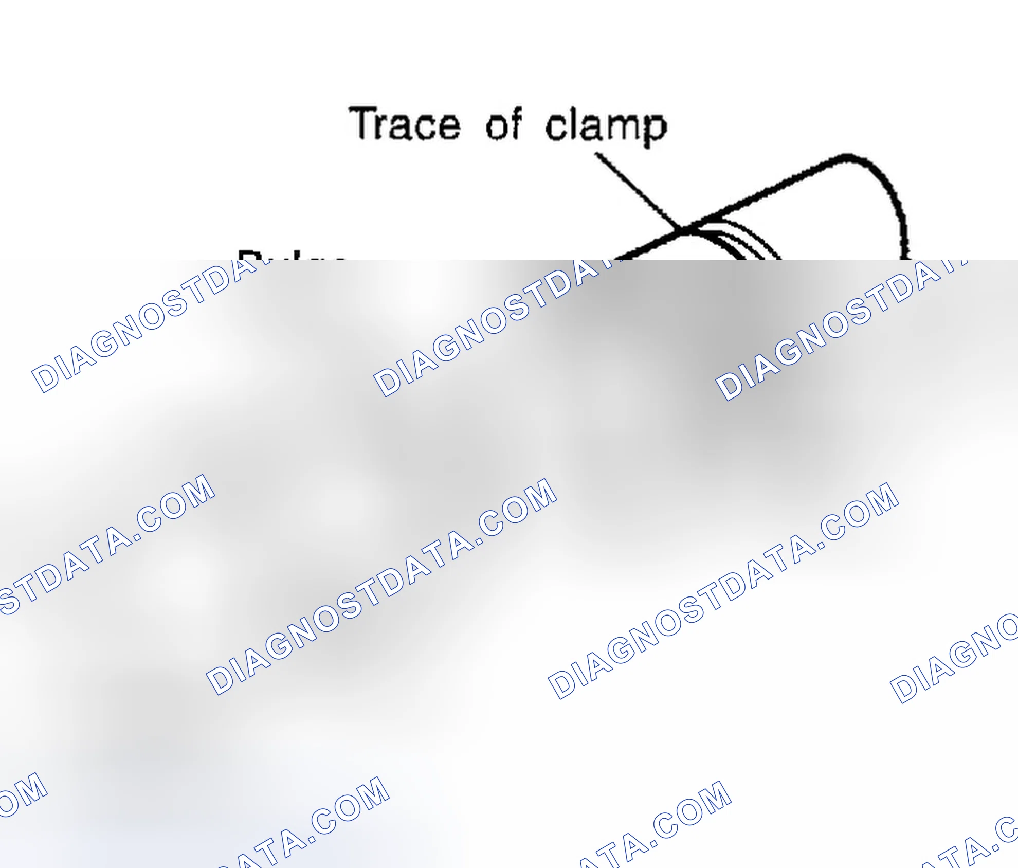 Scheme 48: Hose clamping