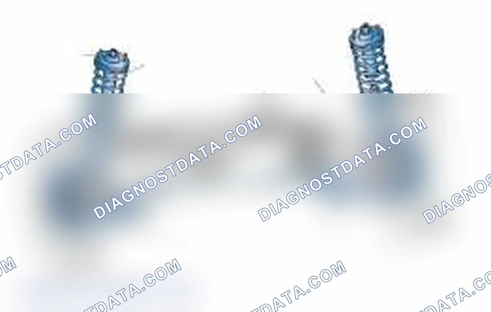 Scheme 25: Typical Front Suspension & Steering Components