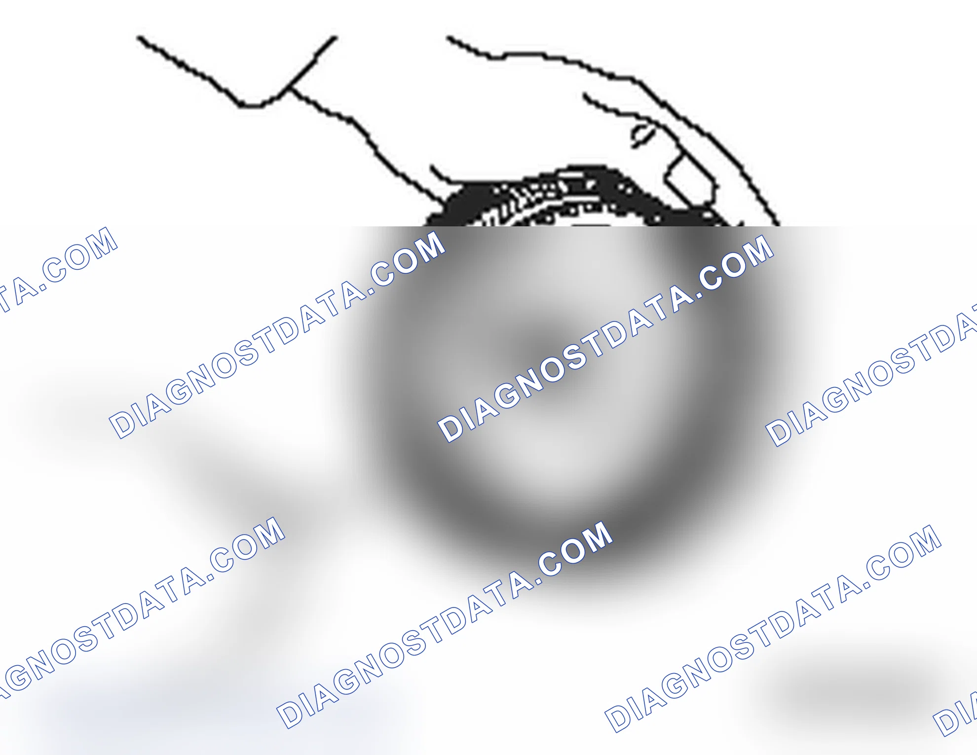 Scheme 250: << A >> SNAP RING REMOVAL