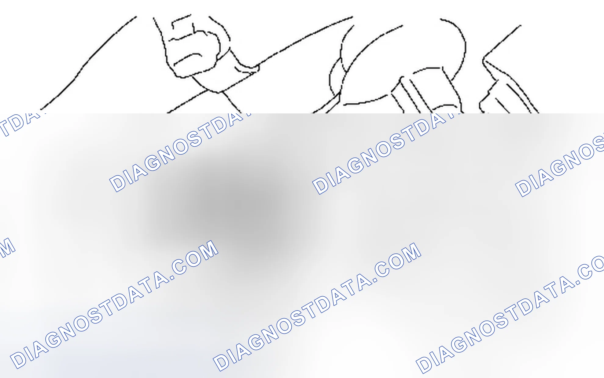 Scheme 31: REMOVAL