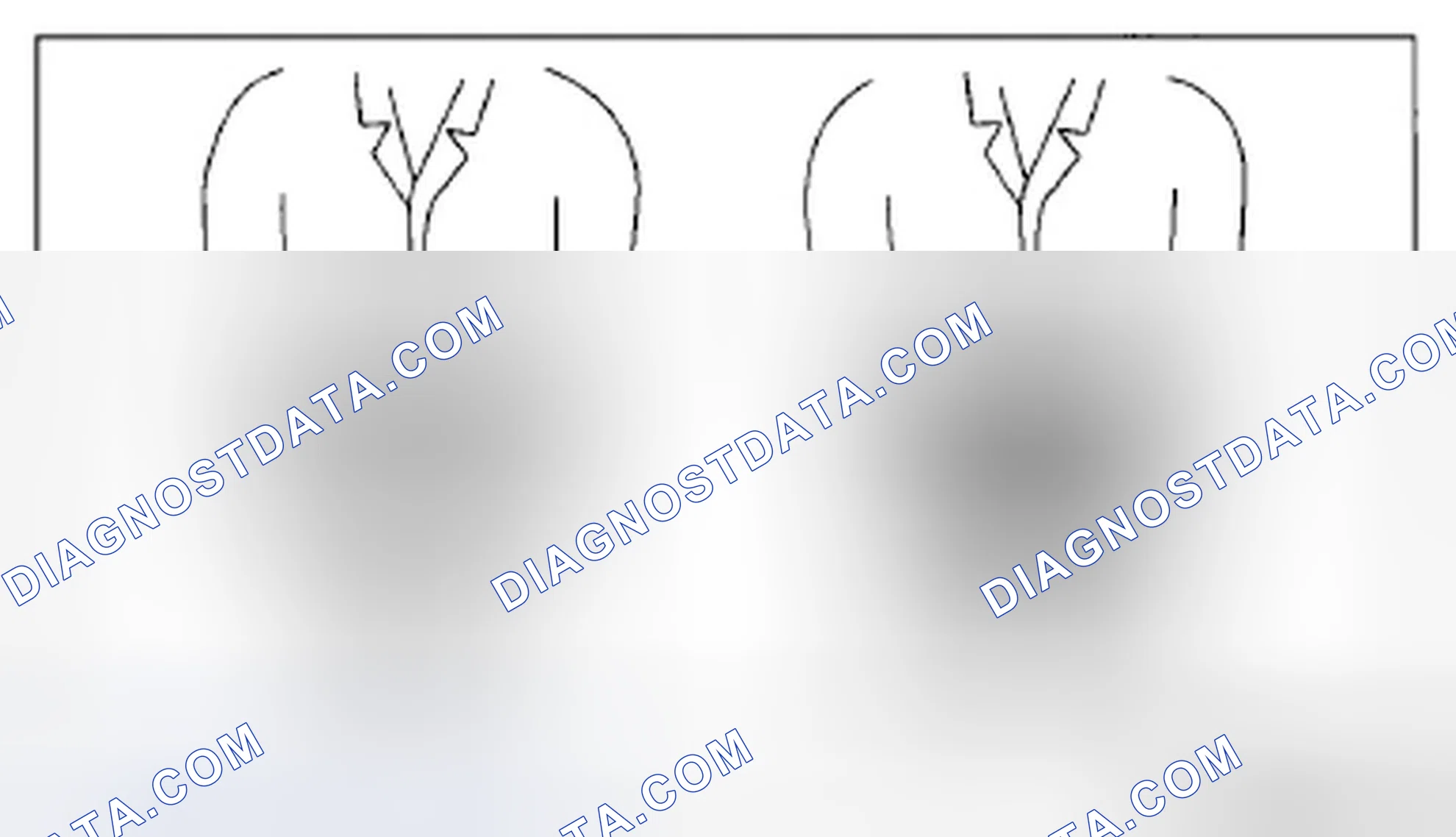 Scheme 139: Air Bag Module Handling