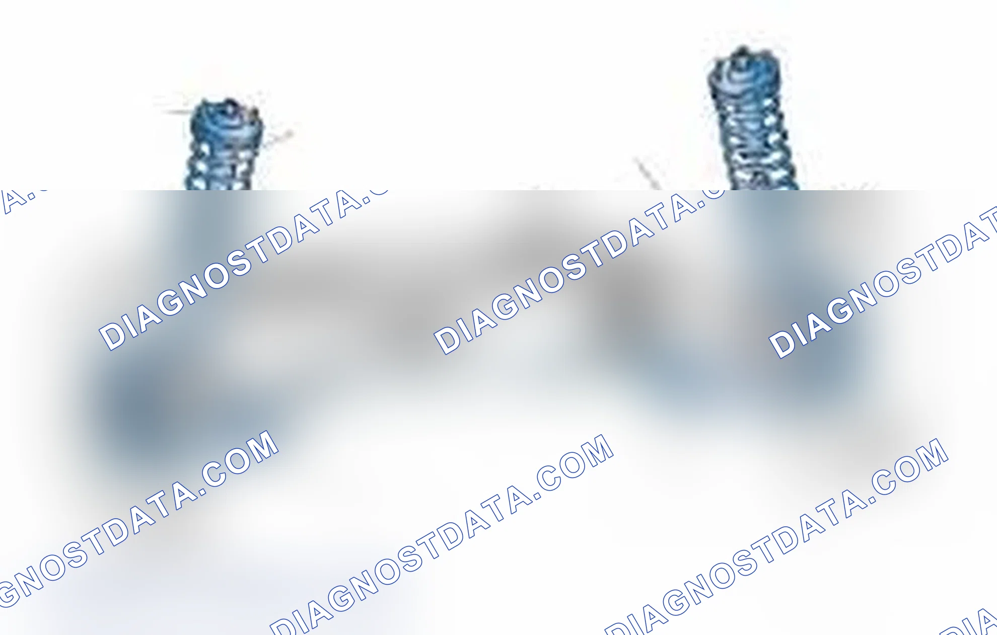 Scheme 25: Typical Front Suspension & Steering Components