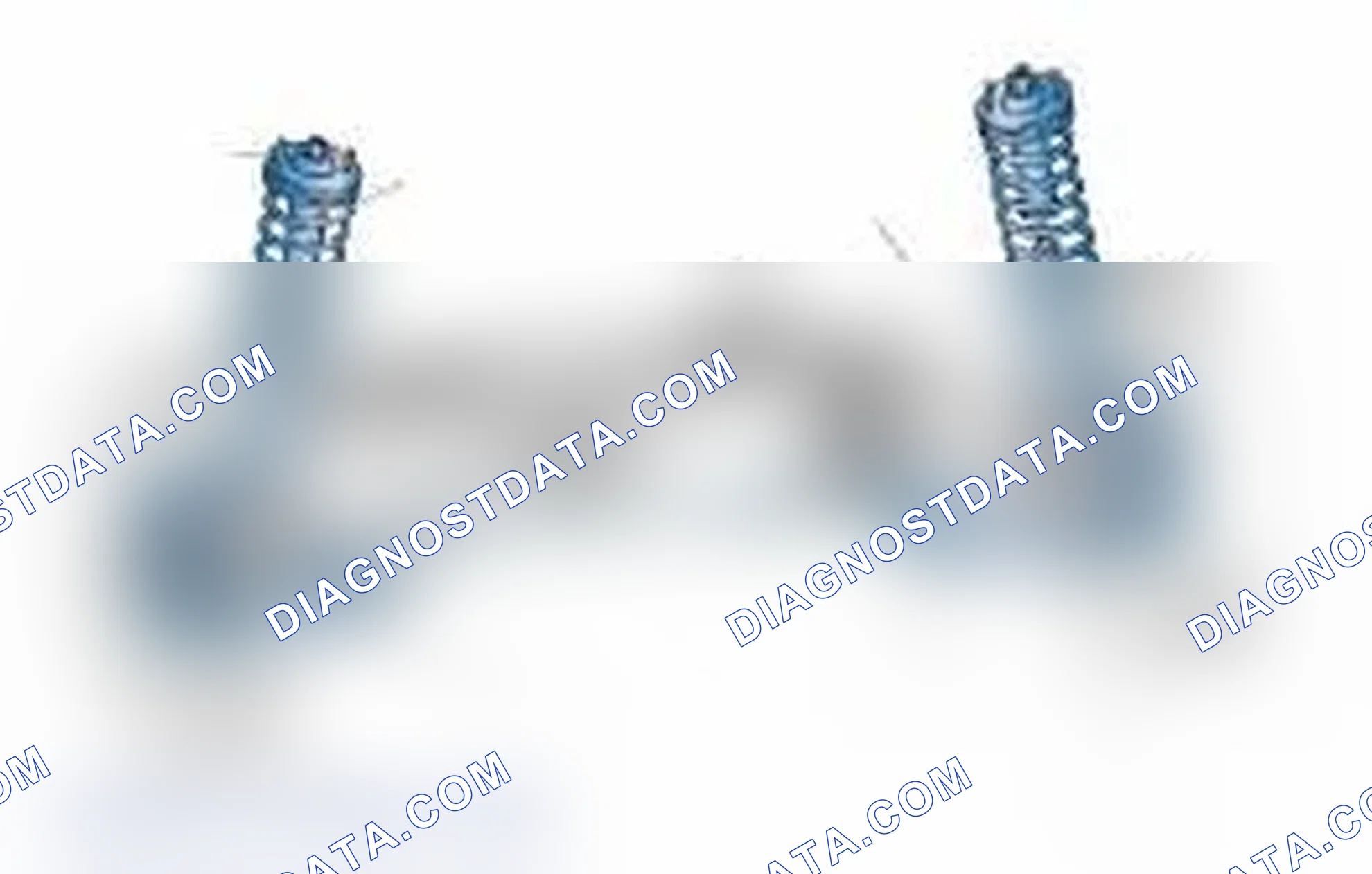 Scheme 25: Typical Front Suspension & Steering Components