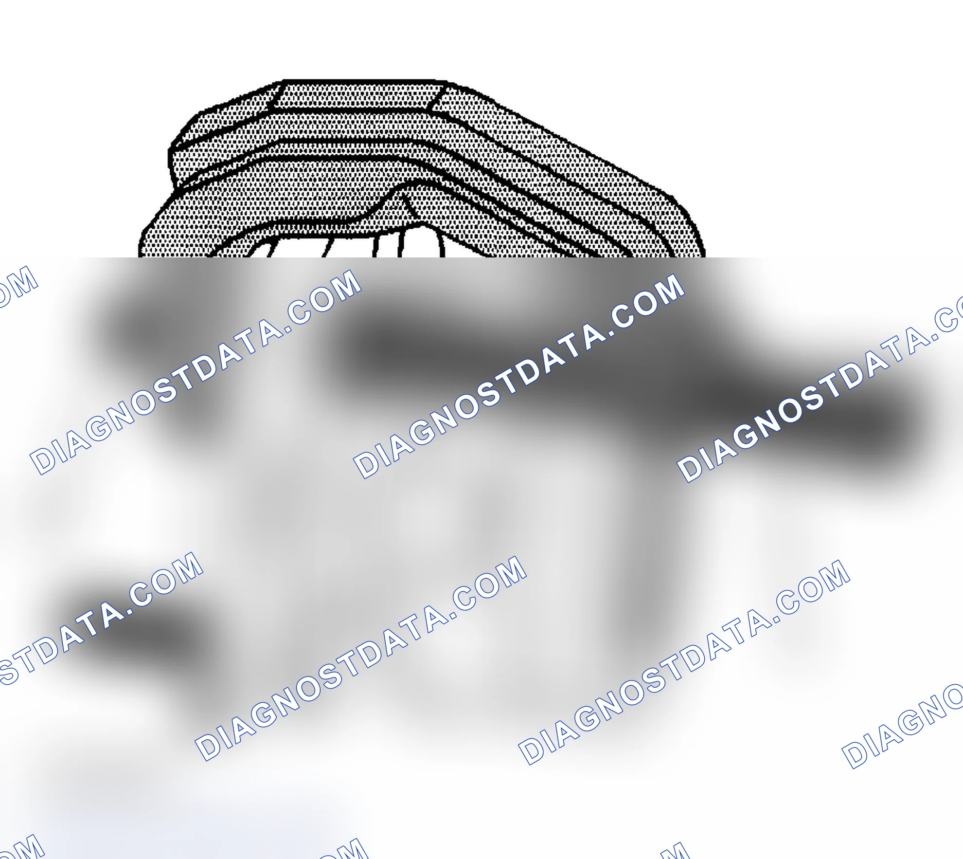 Scheme 139: Installation Procedure