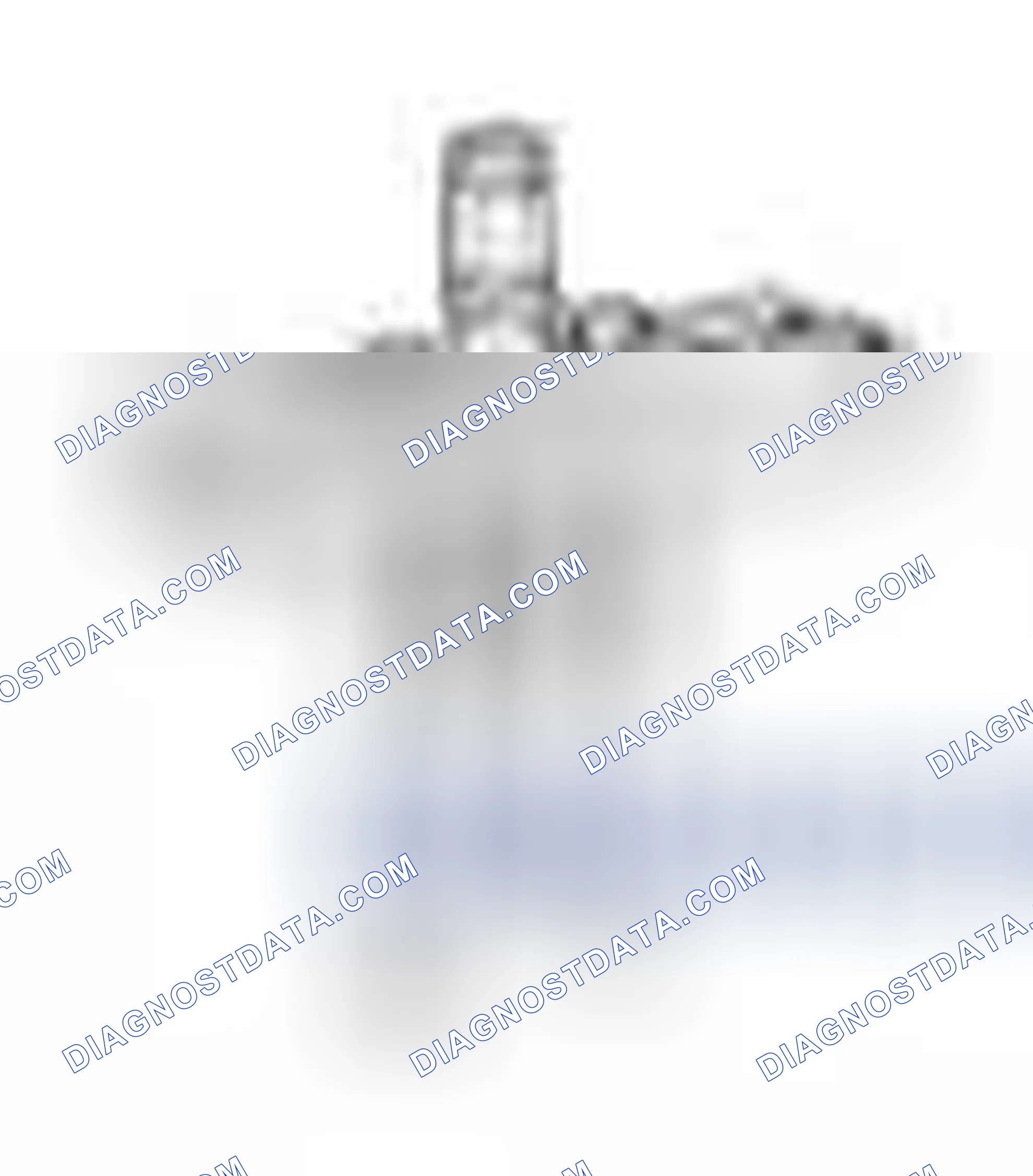 Scheme 1: Special Service Tools