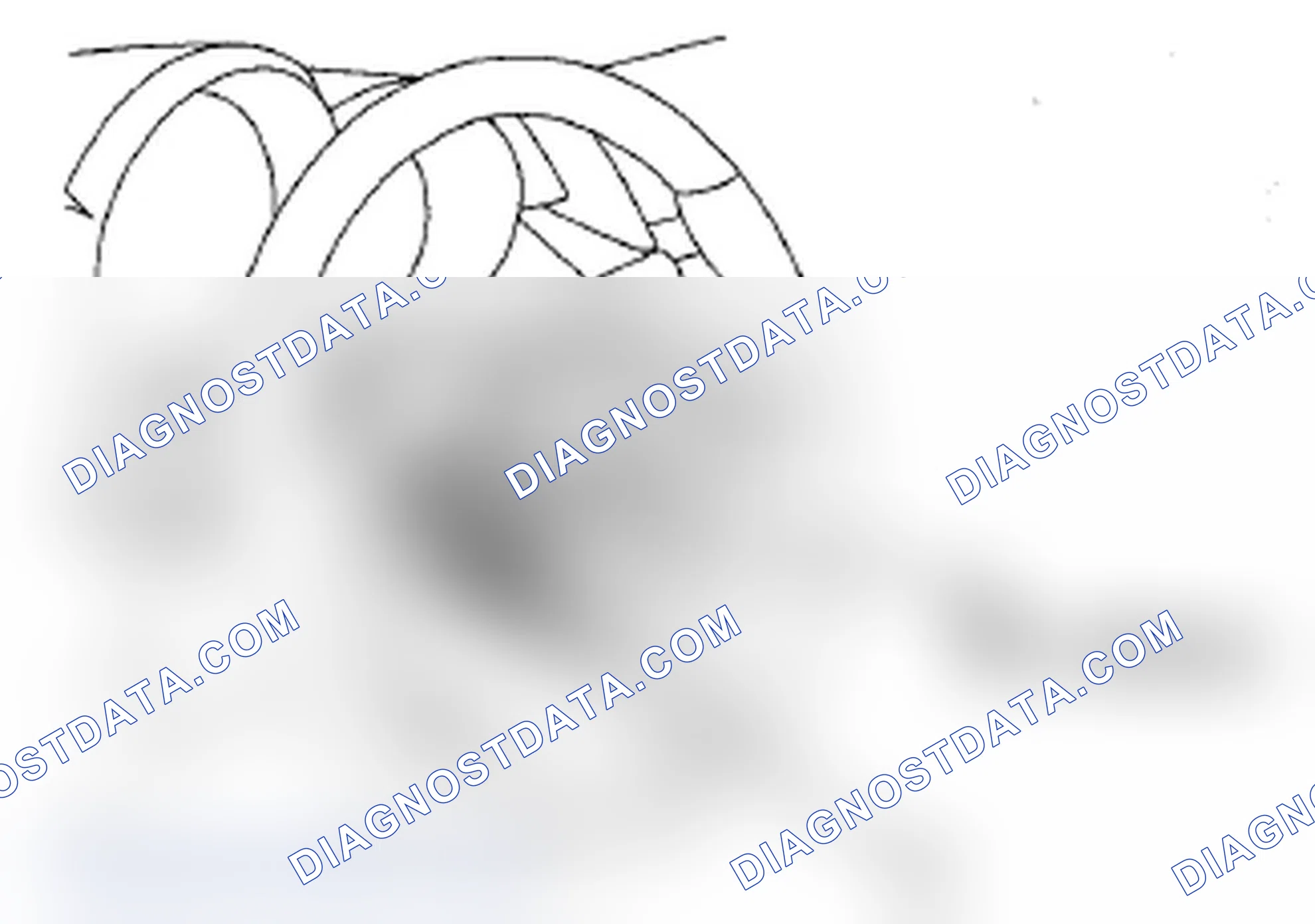 Scheme 6: Steering Wheel Removal