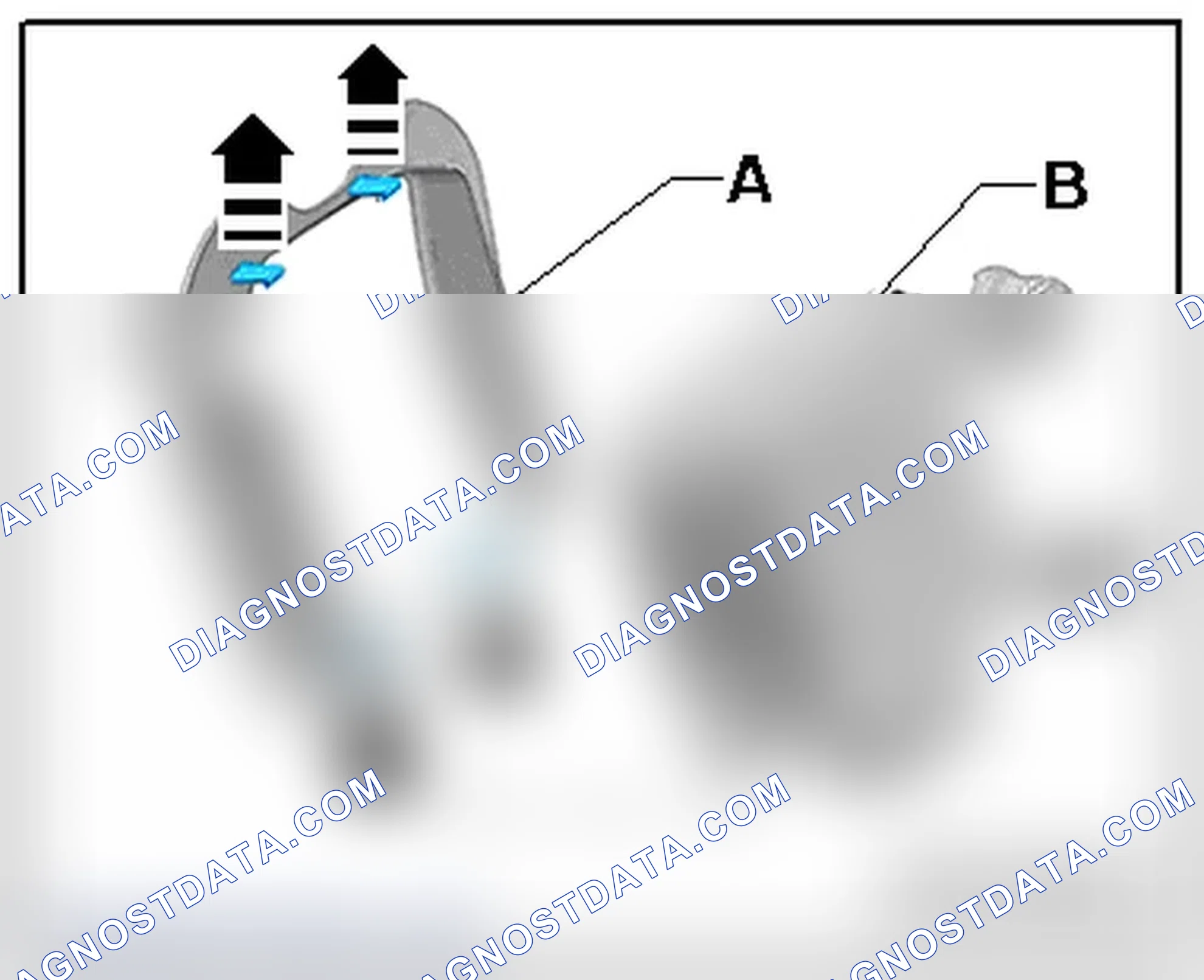 Scheme 148: REMOVING THE COVER FROM THE ADAPTIVE CRUISE CONTROL SENSOR