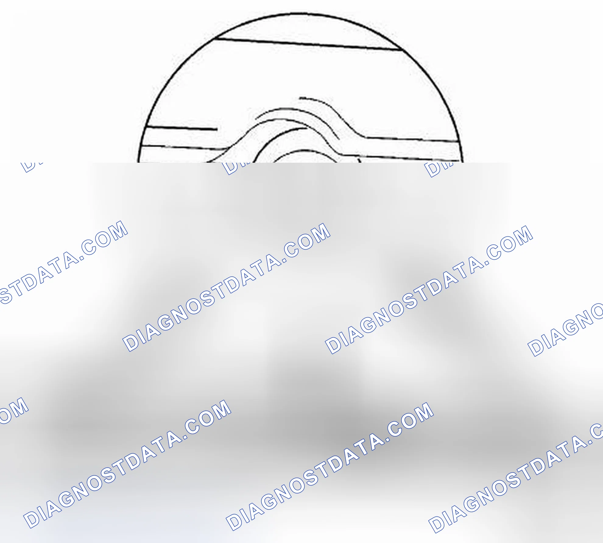 Scheme 22: Removal Procedure