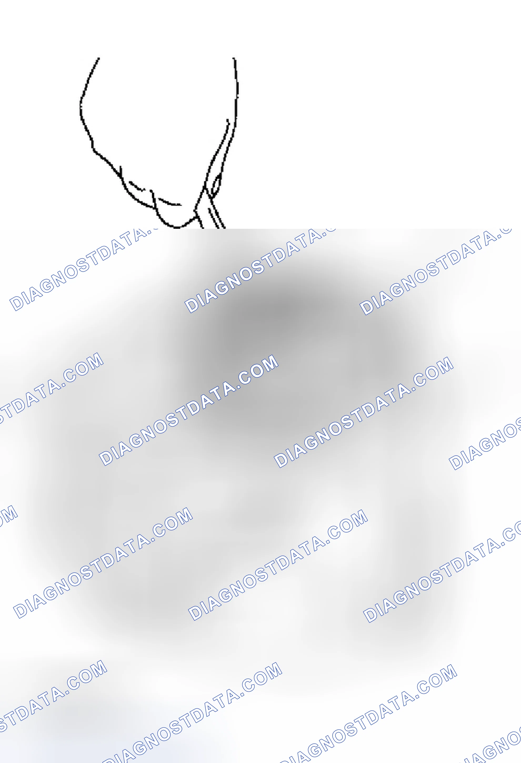 Scheme 71: TOOTH CONTACT
