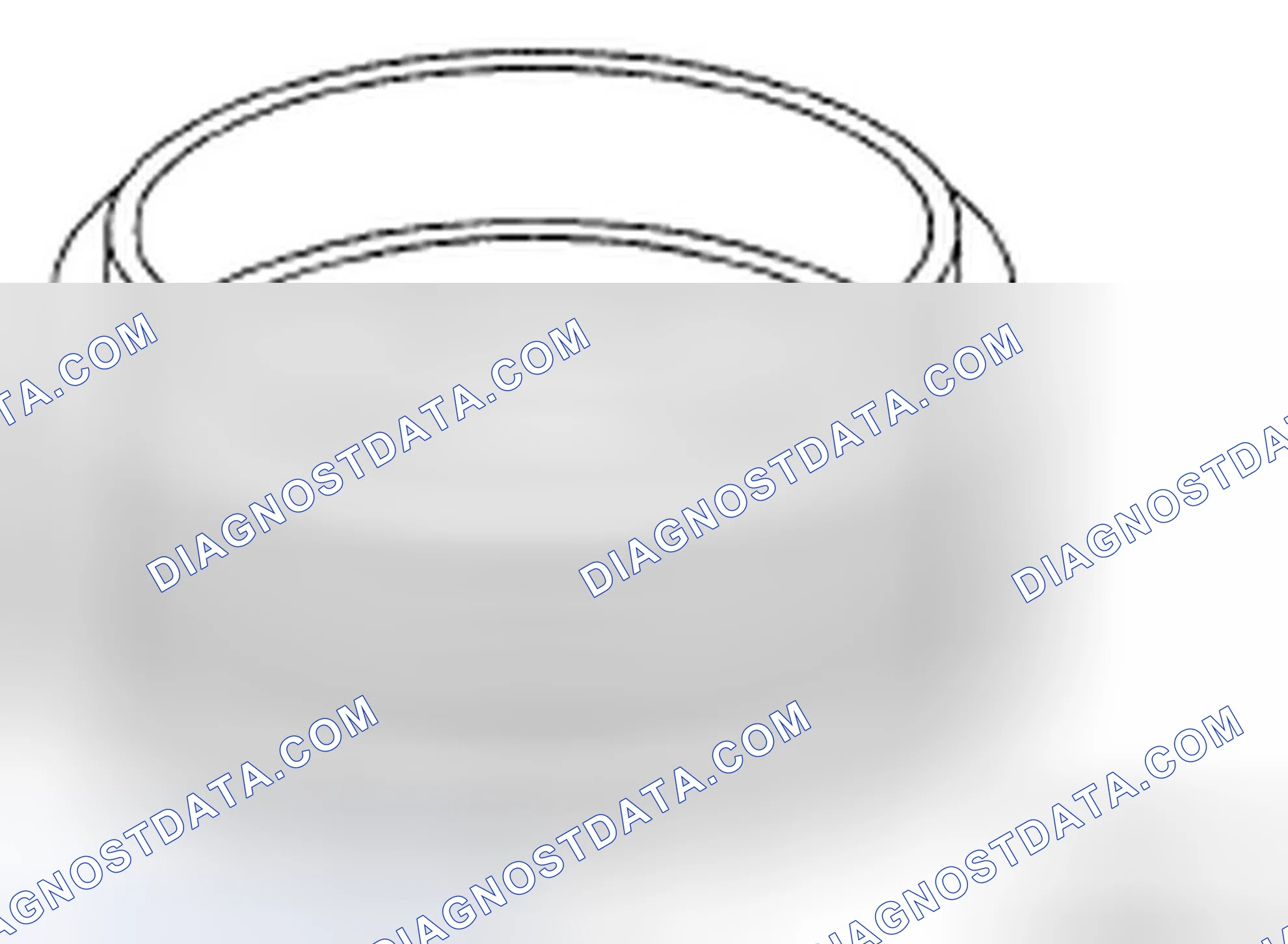 Scheme 201: SIDE RETAINER