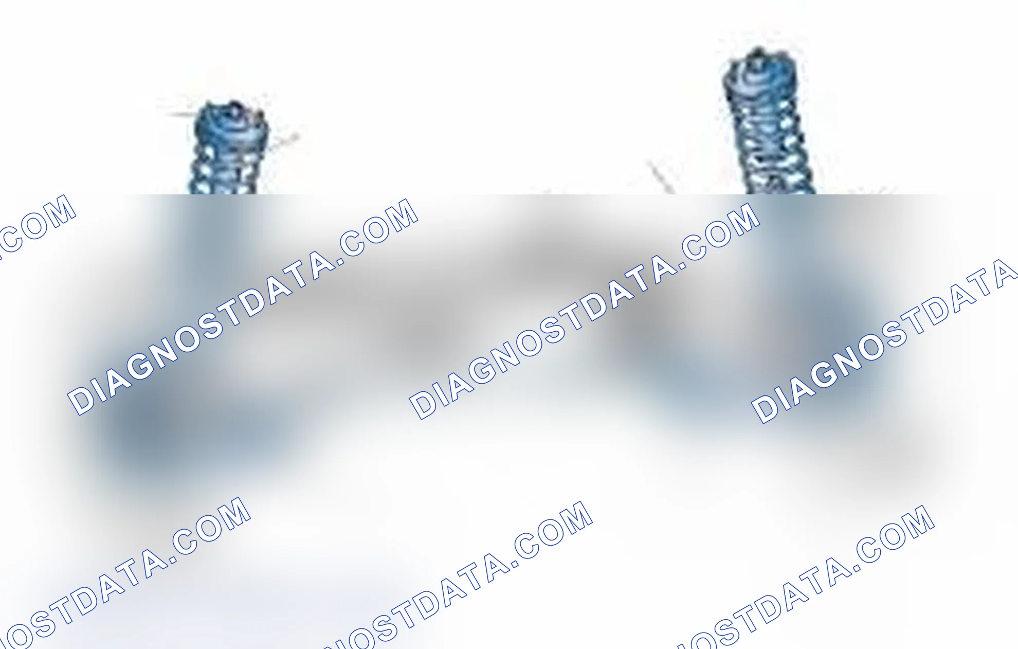 Scheme 25: Typical Front Suspension & Steering Components