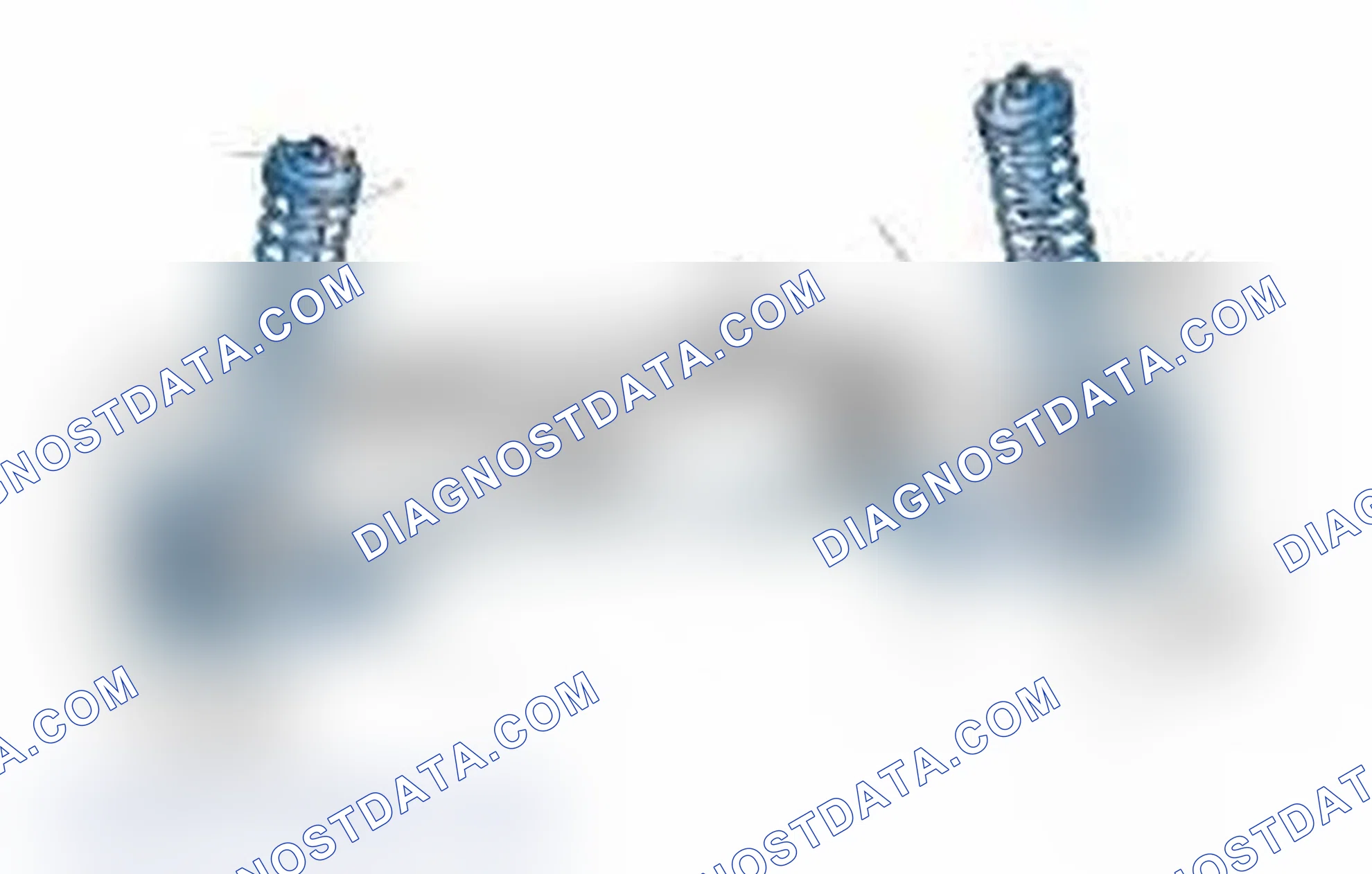 Scheme 25: Typical Front Suspension & Steering Components