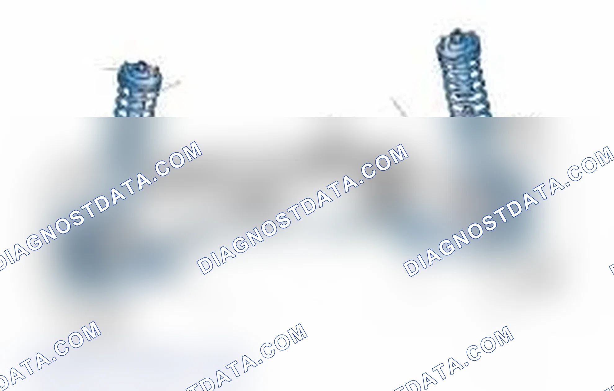 Scheme 25: Typical Front Suspension & Steering Components