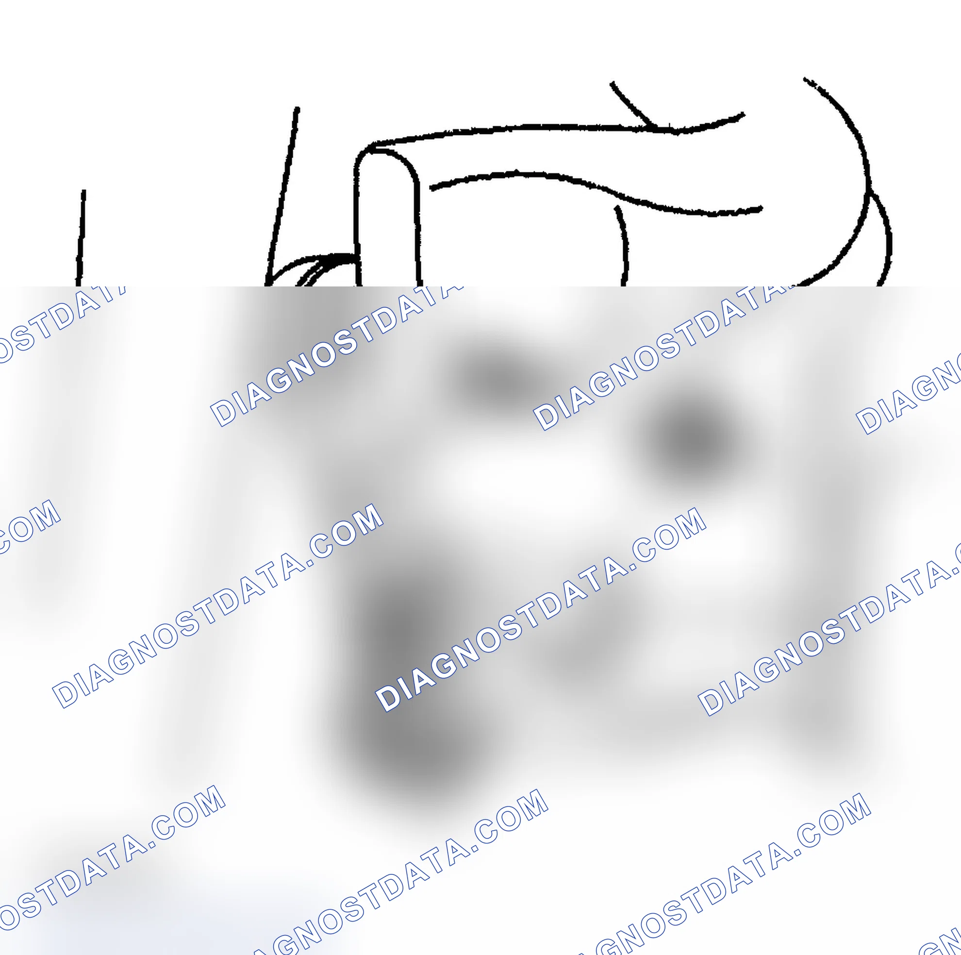 Scheme 8: Removal Procedure