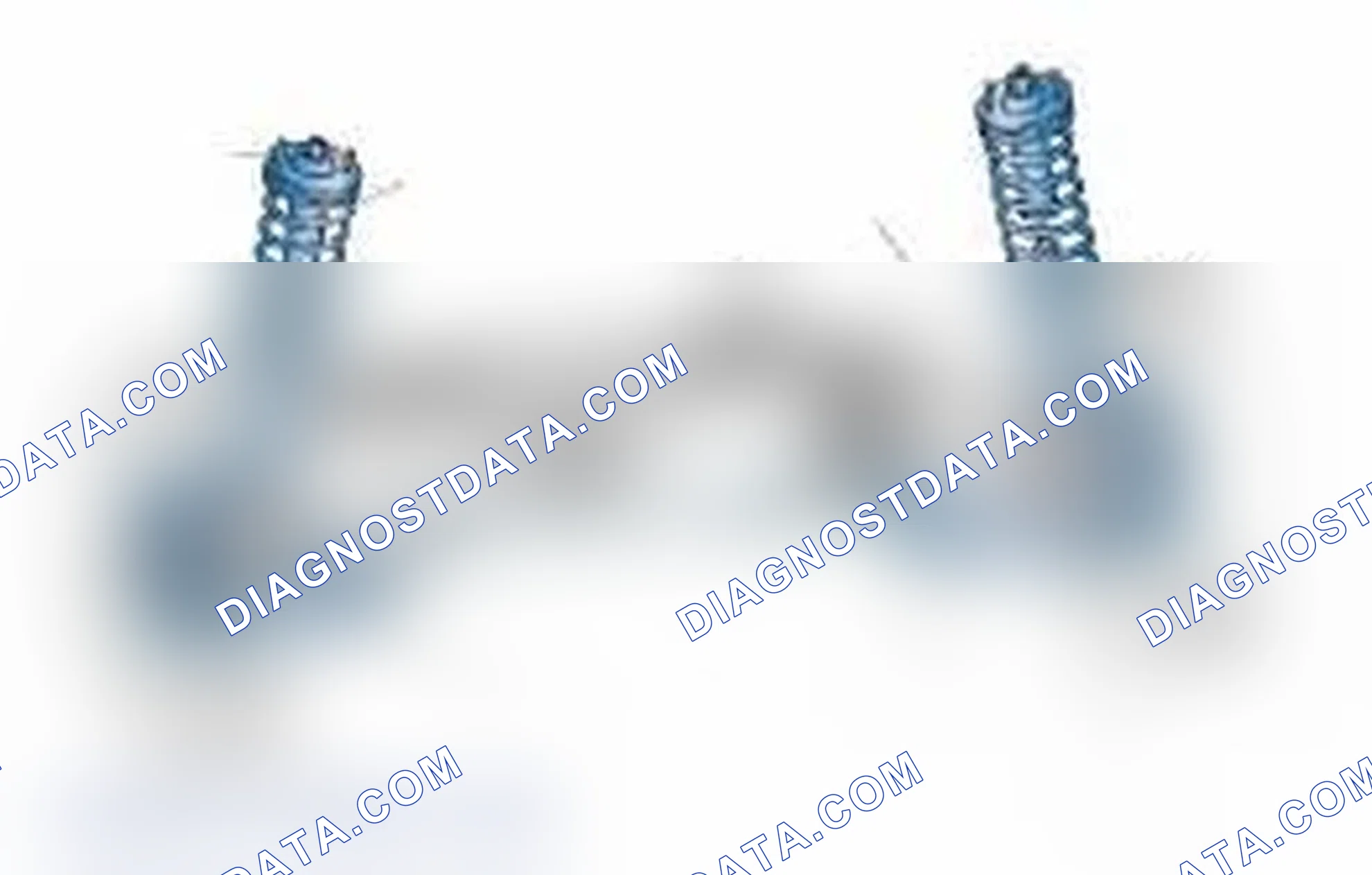 Scheme 25: Typical Front Suspension & Steering Components