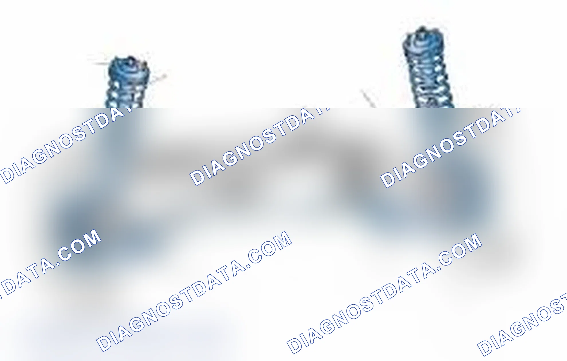 Scheme 25: Typical Front Suspension & Steering Components