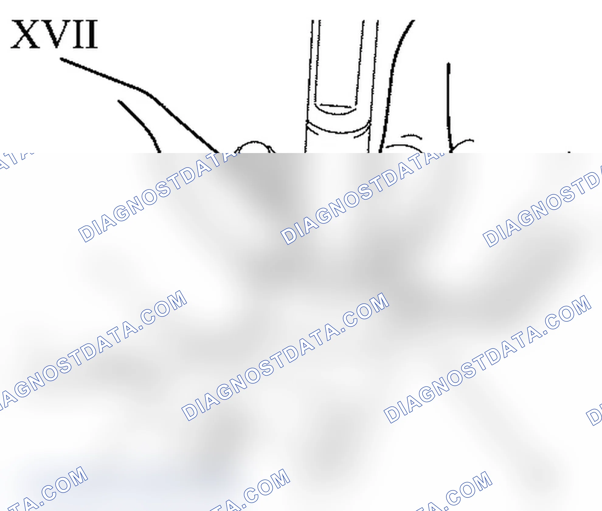 Steering Gear - Noise