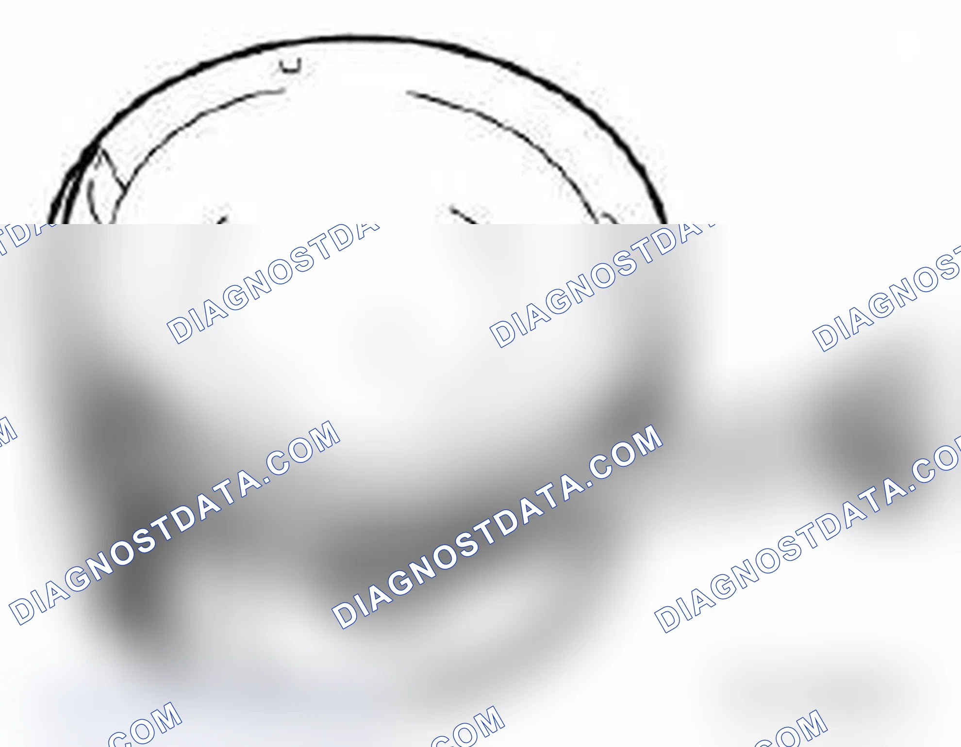 Scheme 532: 11 25 671 REPLACING PISTON RINGS ON ALL PISTONS (N62)