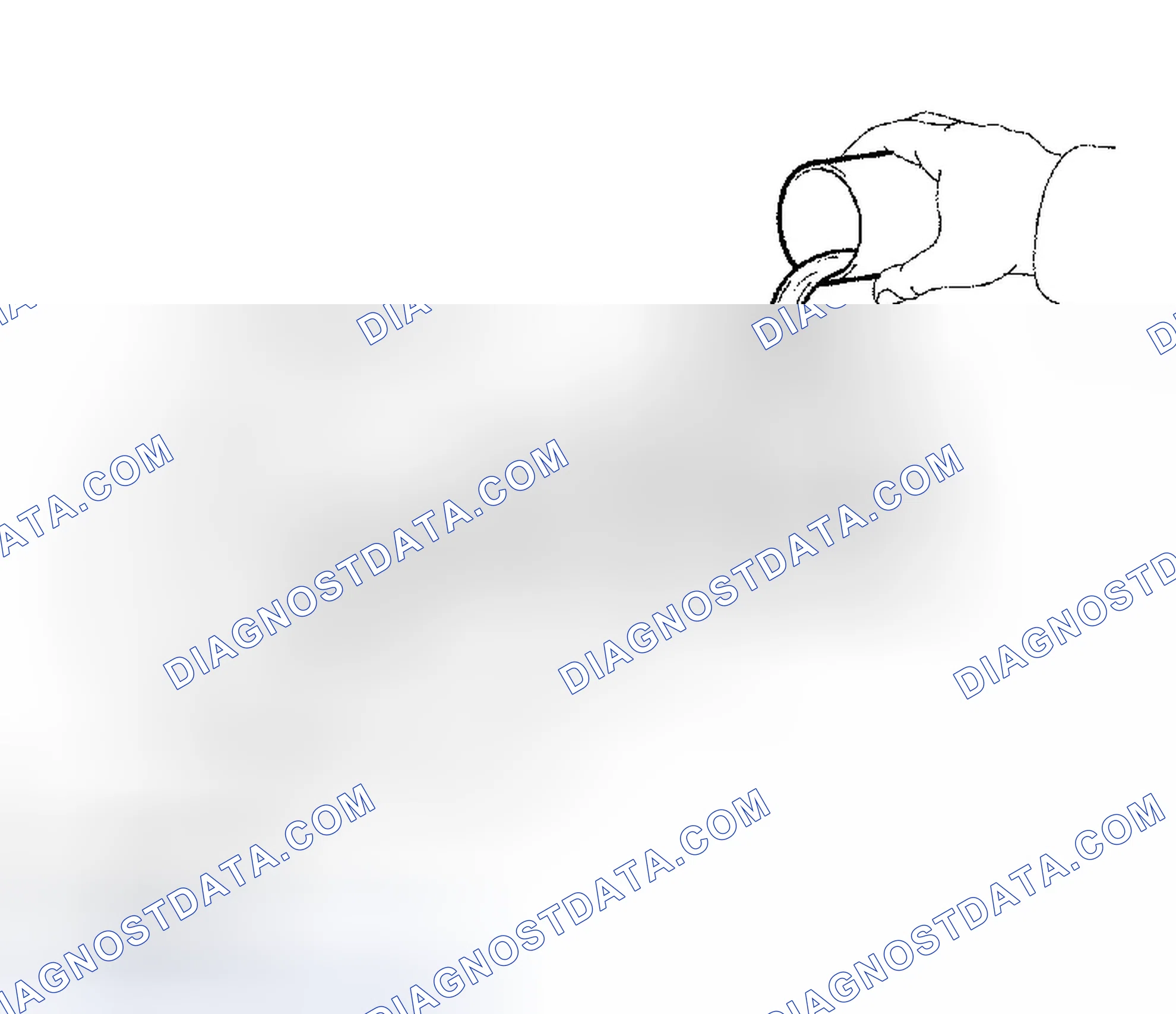 Scheme 82: BLEEDING