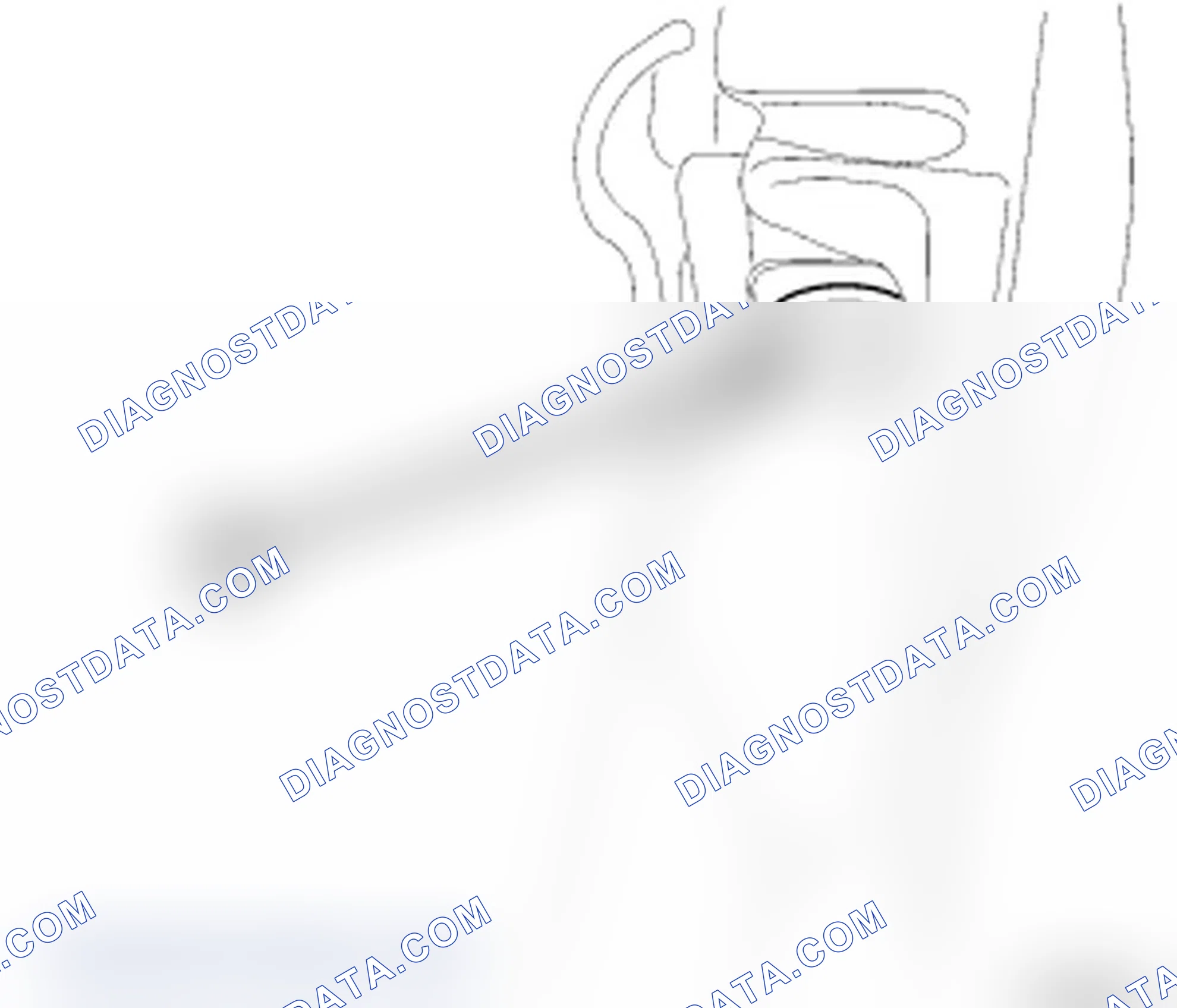 Scheme 12