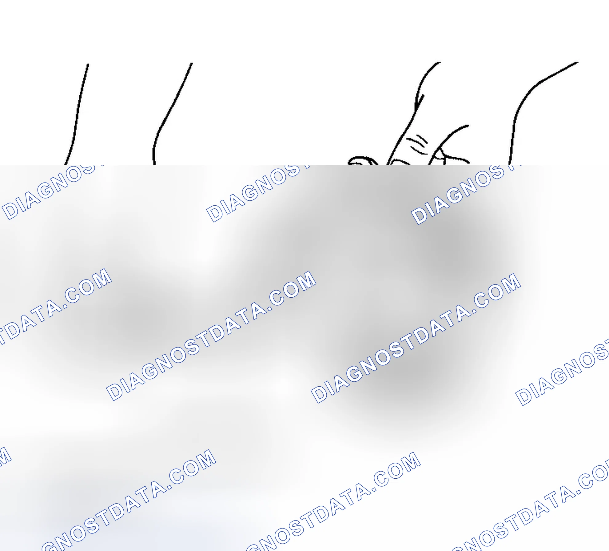 Scheme 231: PISTON SKIRT DIAMETER