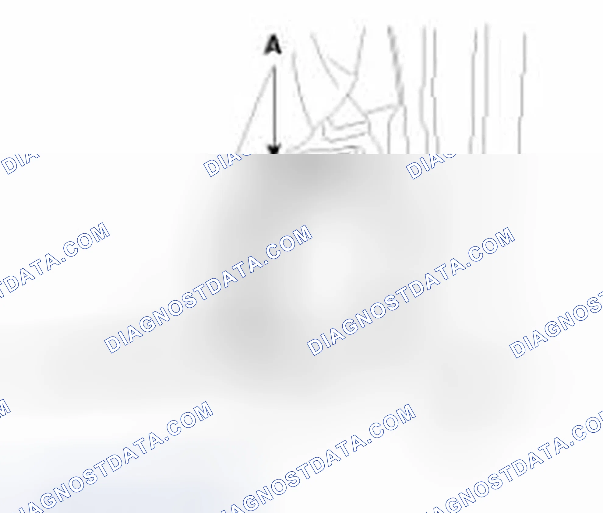 Scheme 53: Front Speaker