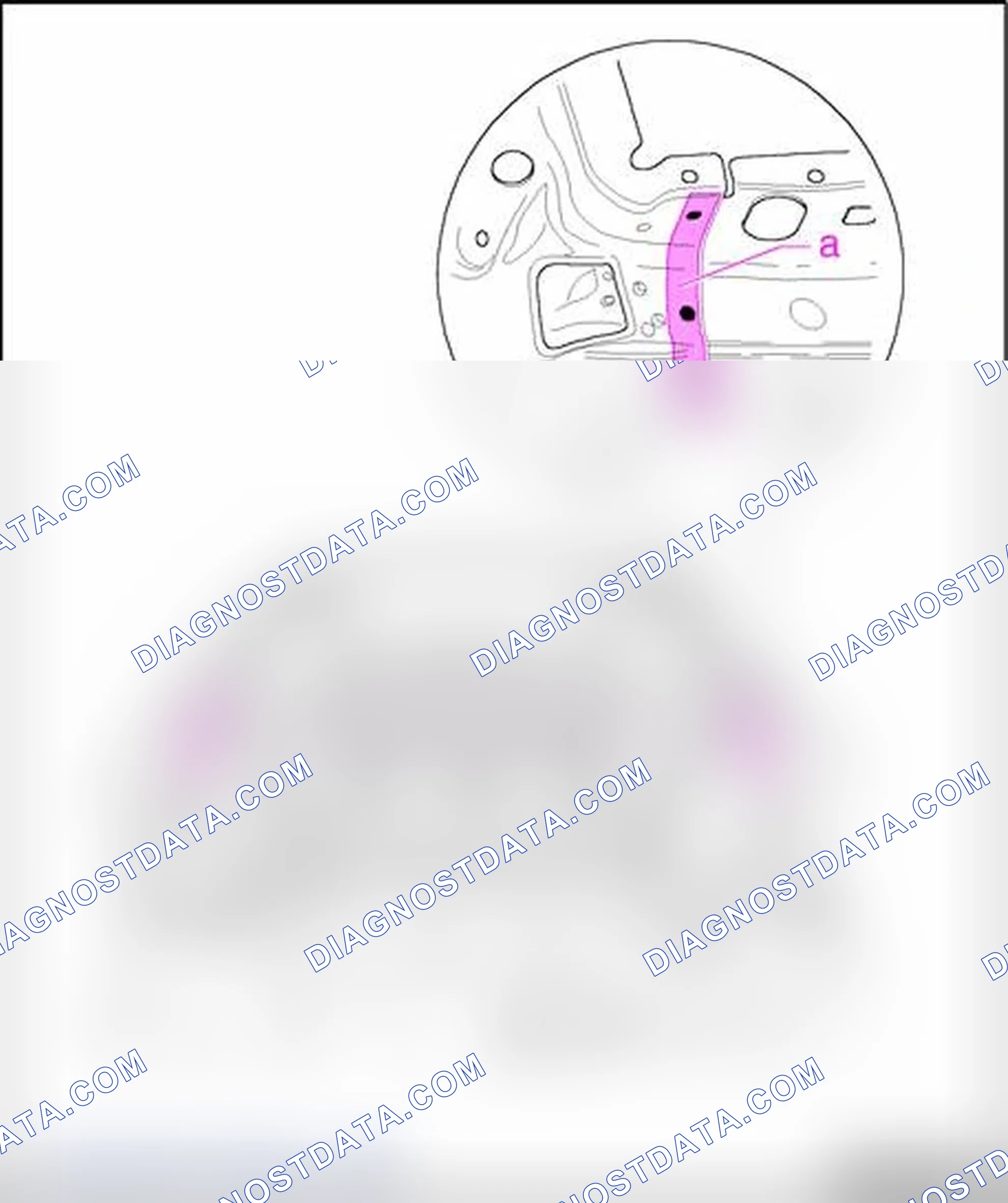 Scheme 98: Cutting locations