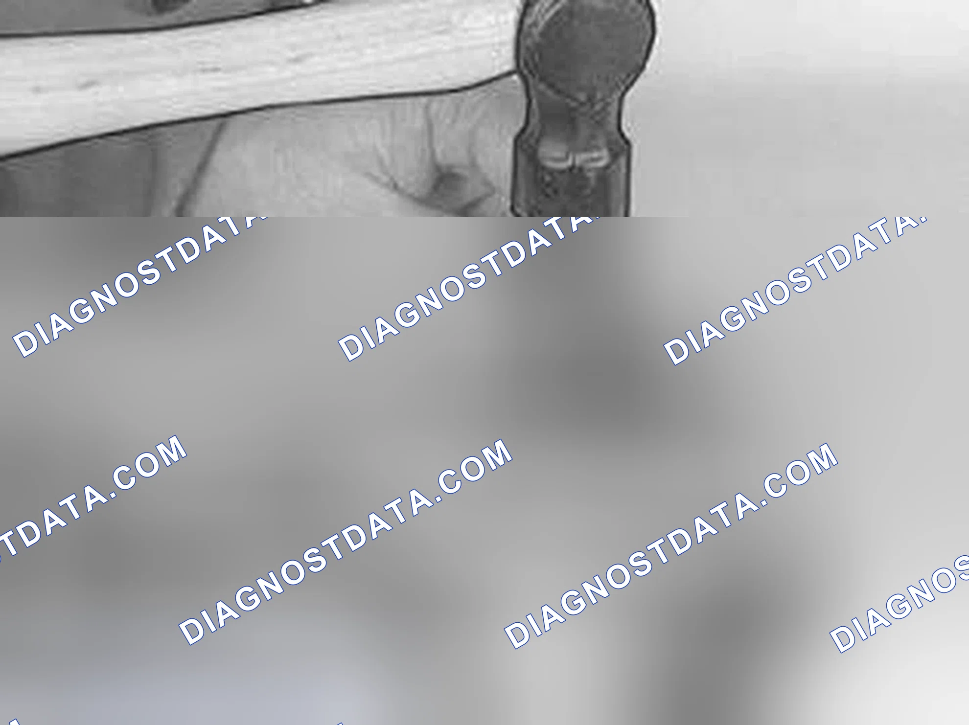Scheme 409: Marking the connecting rod (where applicable)