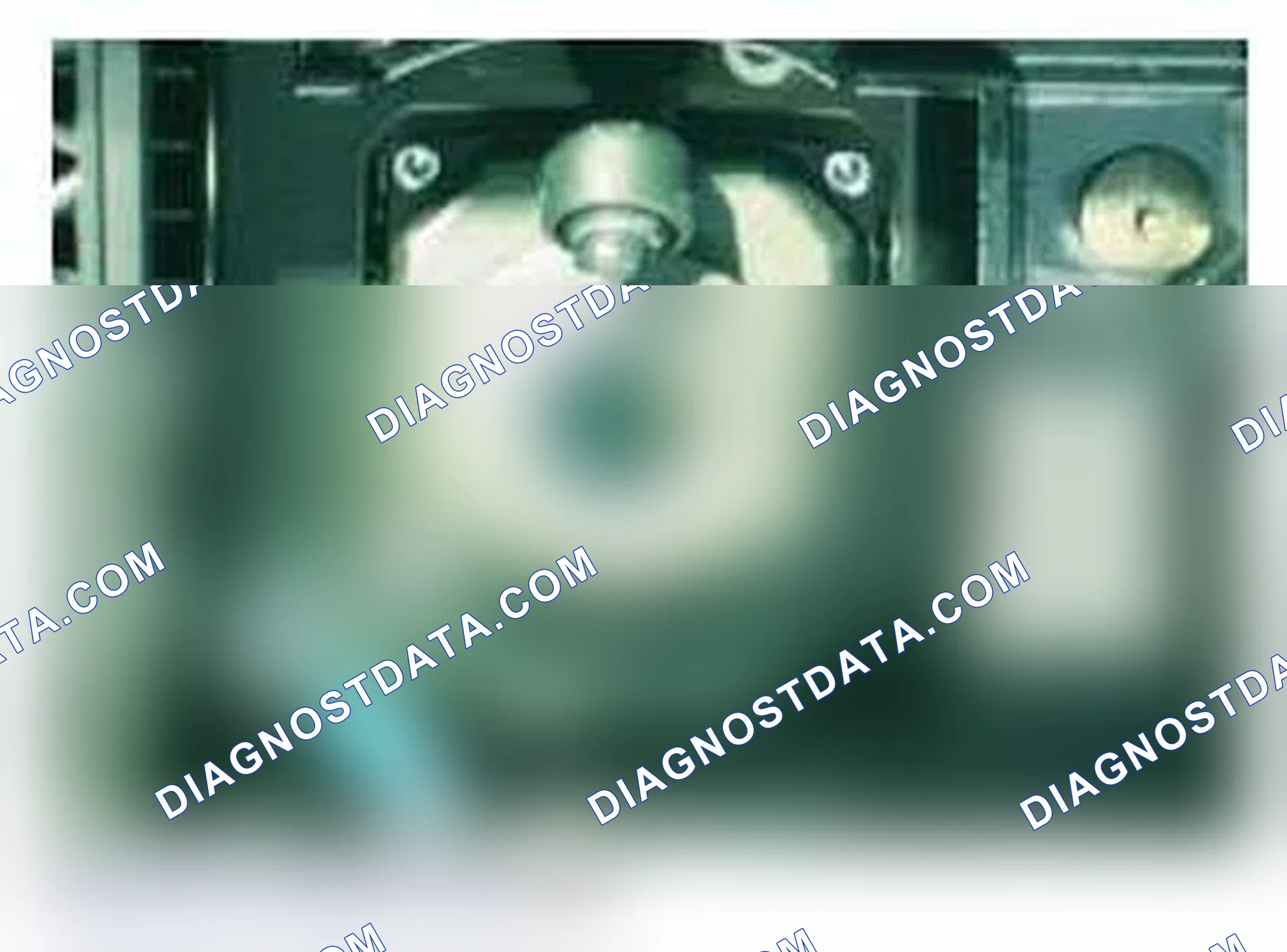 Scheme 86: Axial Camera Adjustment