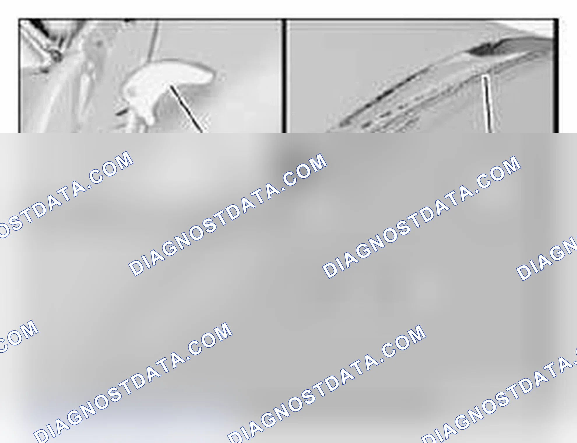 Scheme 335: 61 61 010 Checking/adjusting contact angle of windshield wiper arms on windshield