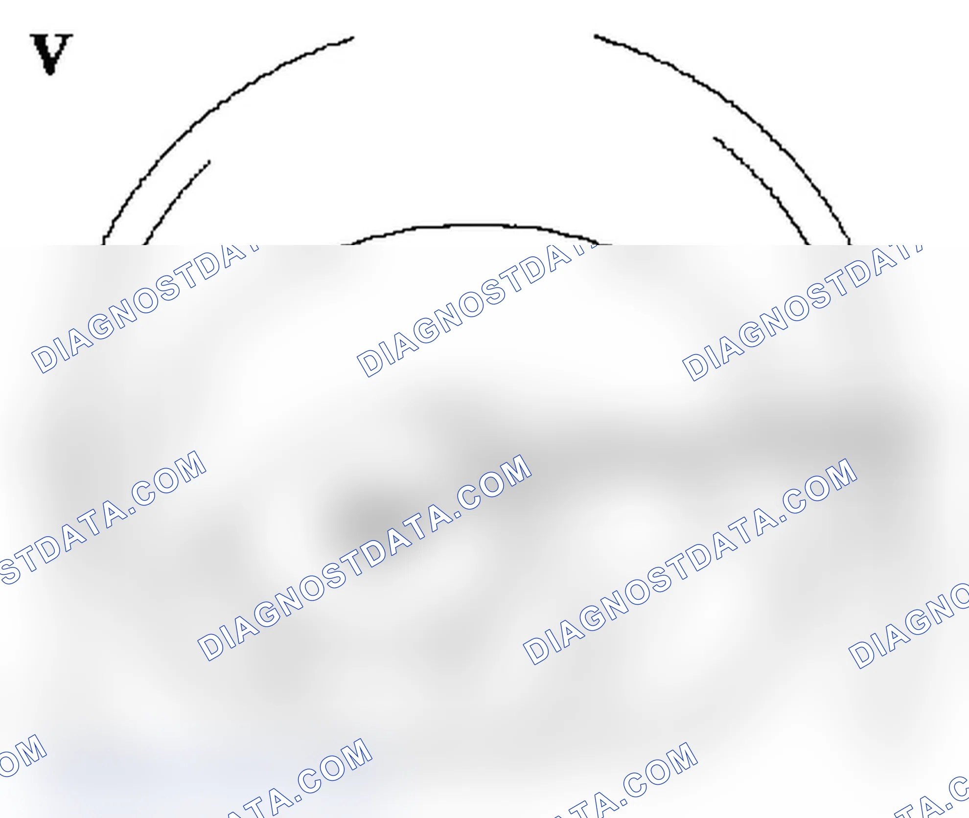Spring Checkvalve - Remove