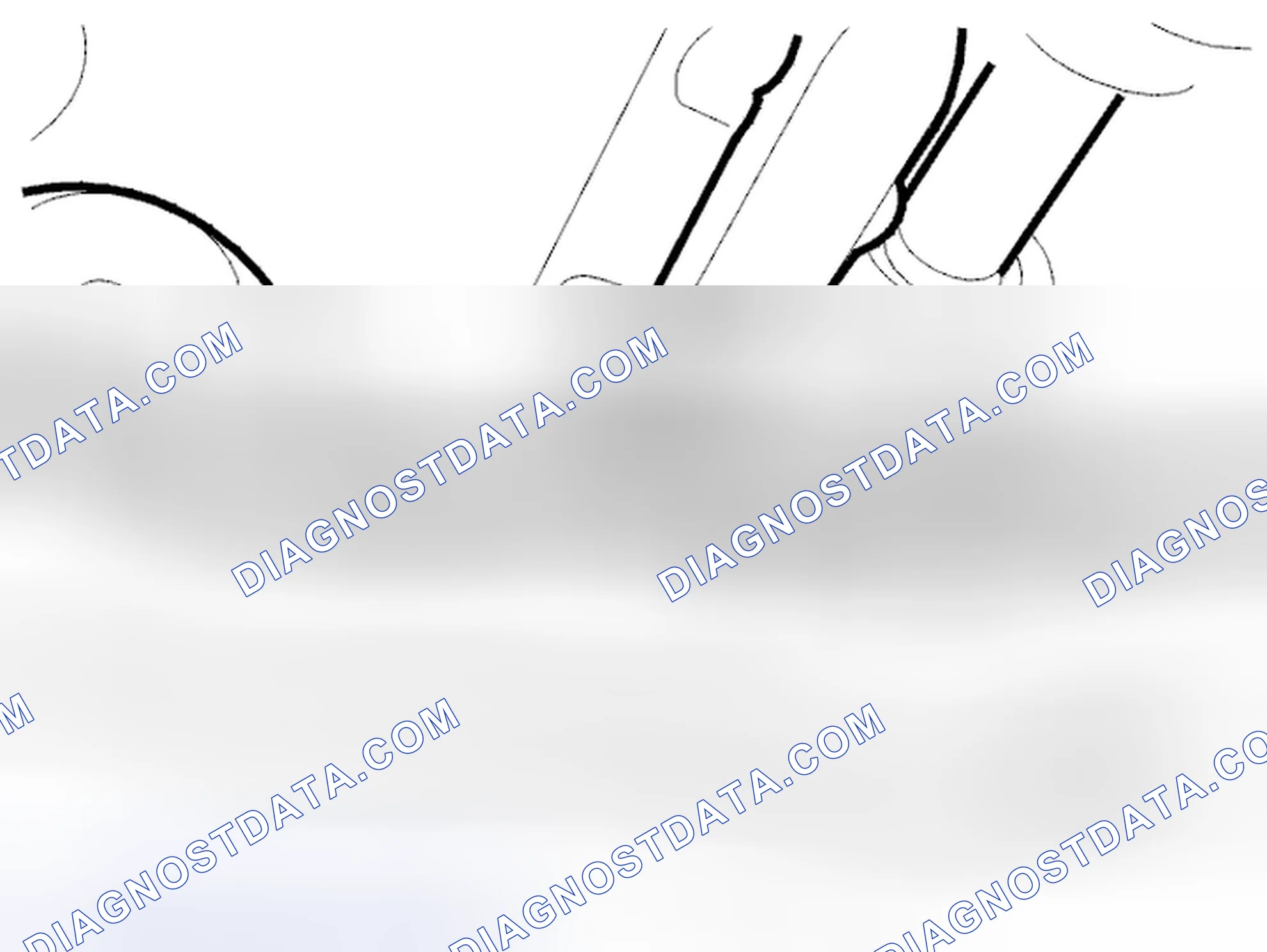 Scheme 116: Removing the delivery line for the steering gear