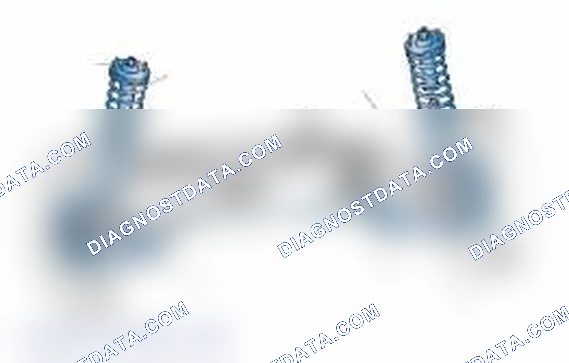 Scheme 25: Typical Front Suspension & Steering Components