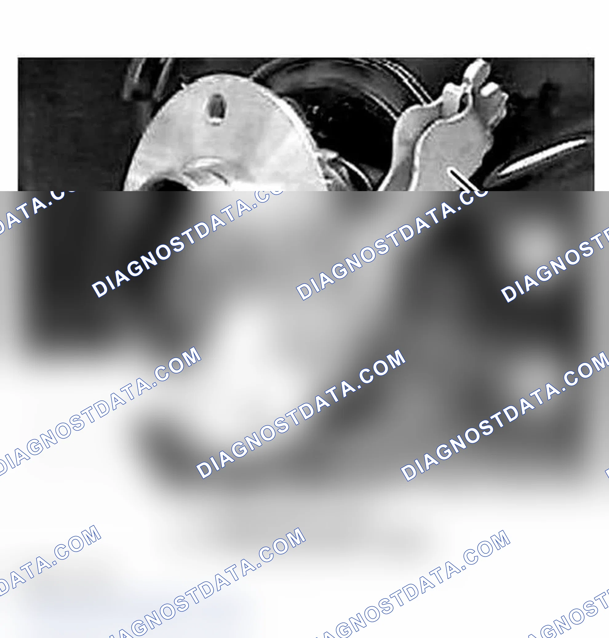 Scheme 48: Removal & Installation