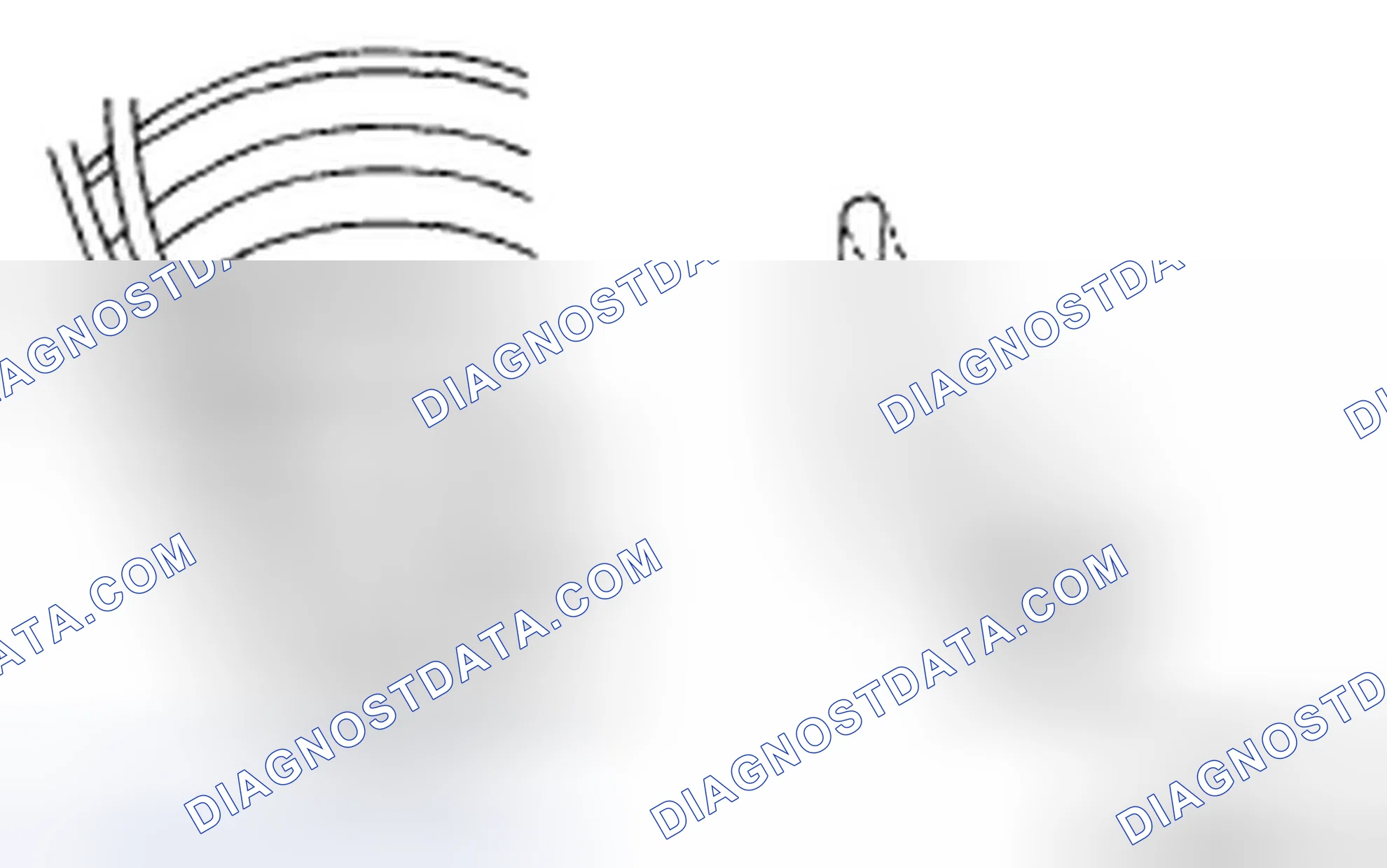 Scheme 65: MASTER CYLINDER