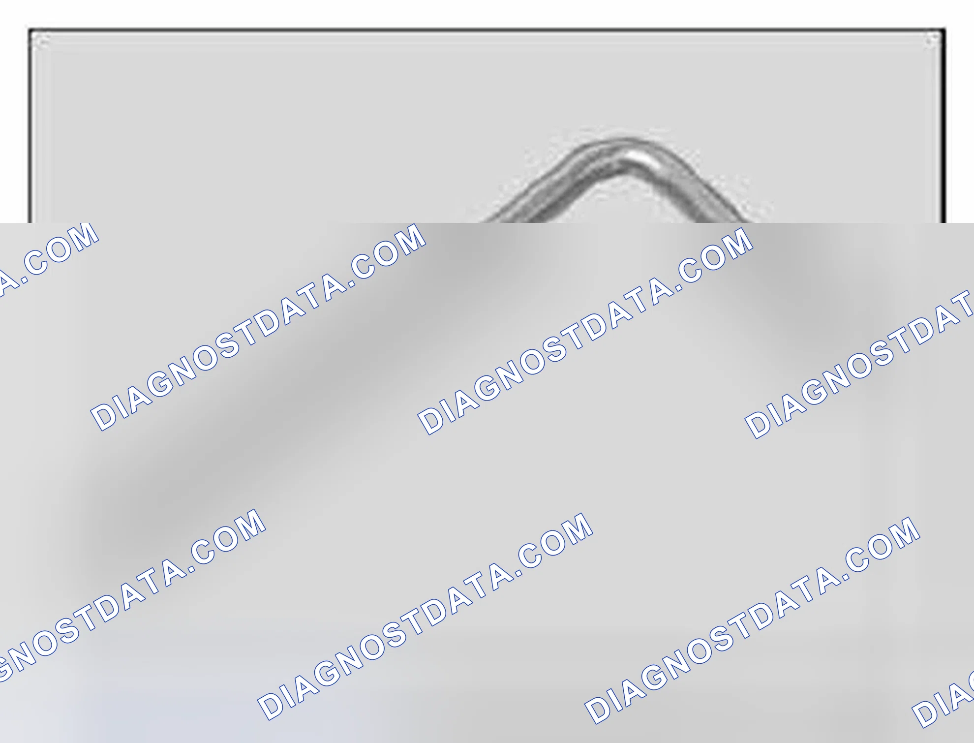Scheme 381: 11 0 390 Clamping pin