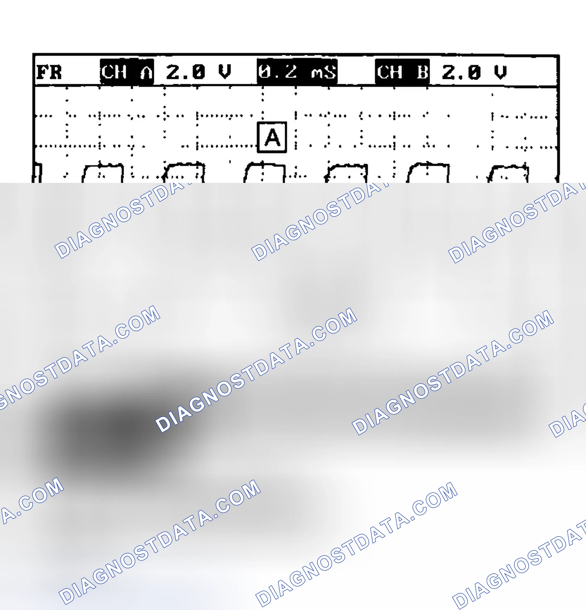 Scheme 47: SIGNAL WAVEFORM
