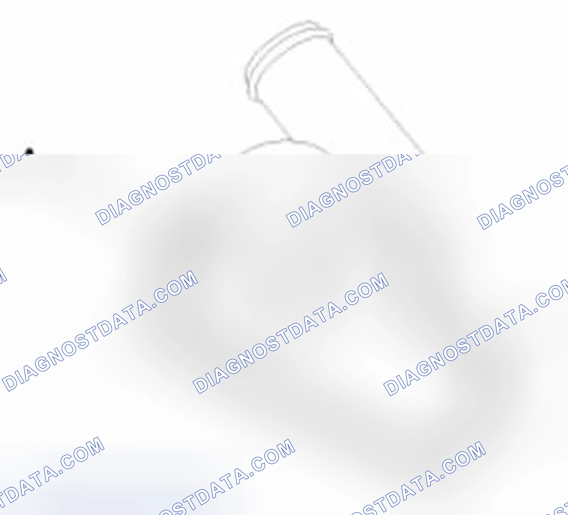 Scheme 46: Installation