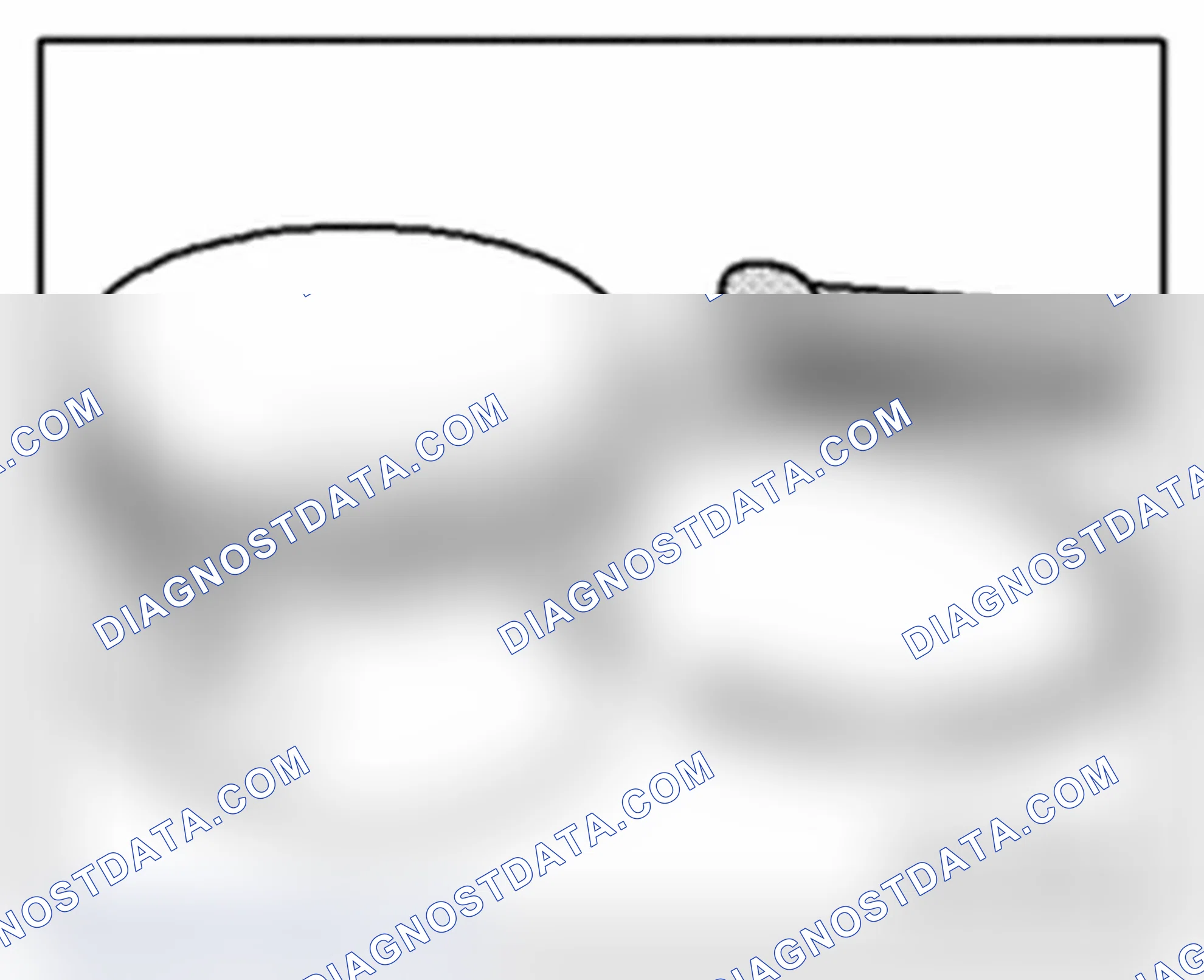 Scheme 142: Checking ring to groove clearance