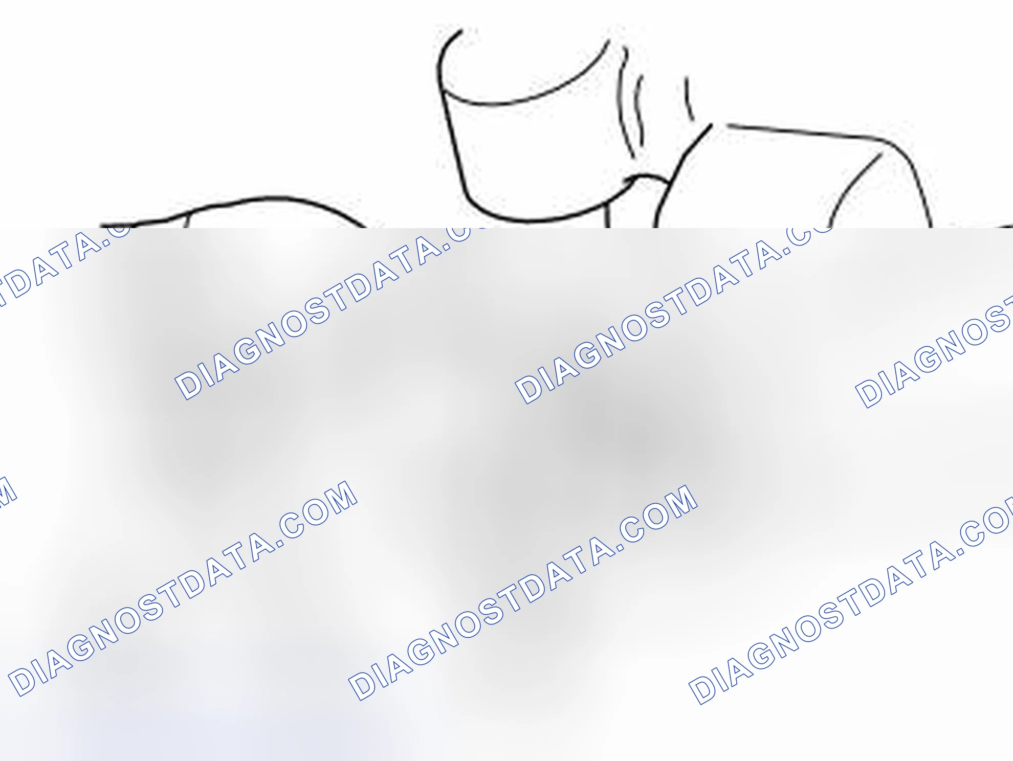 Scheme 100: Cleaning crankcase ventilation