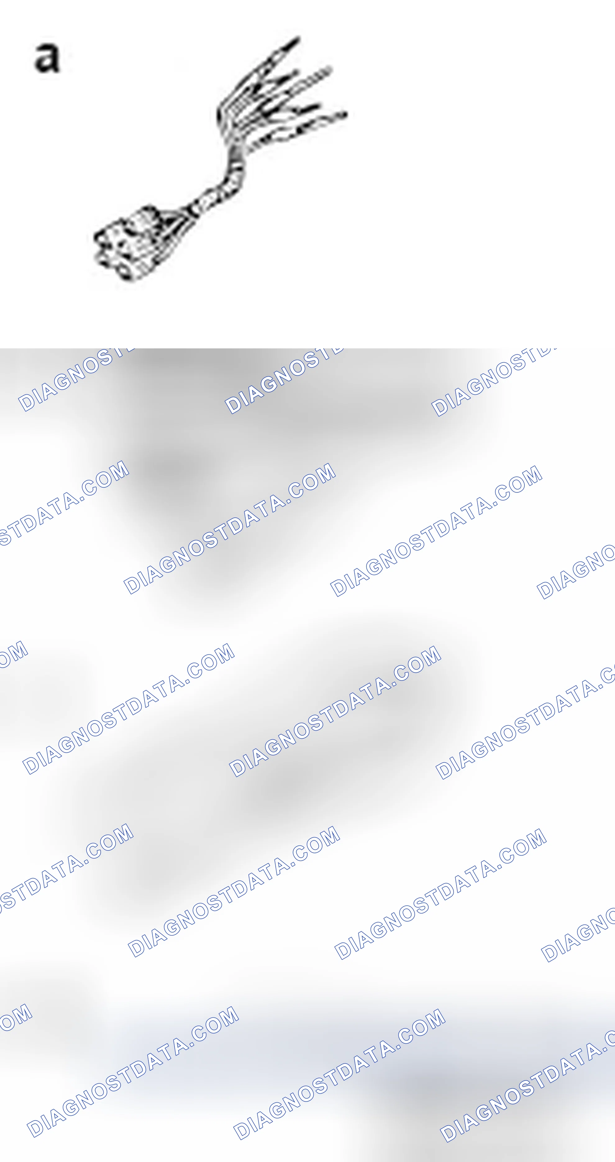 Scheme 18: SPECIAL TOOLS
