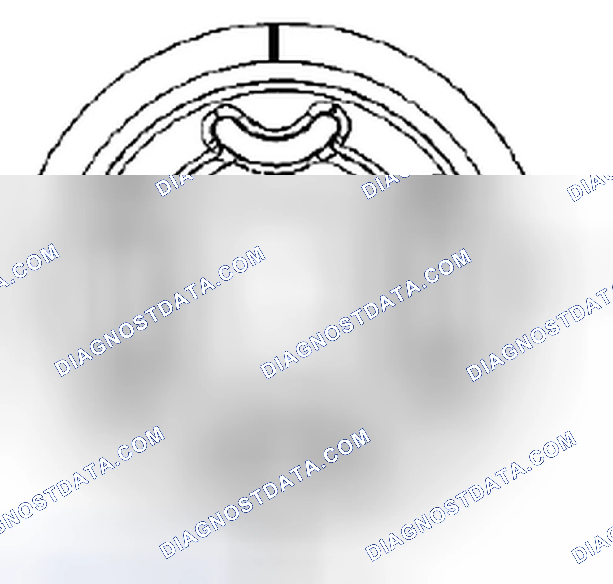Scheme 28: Installation Procedure