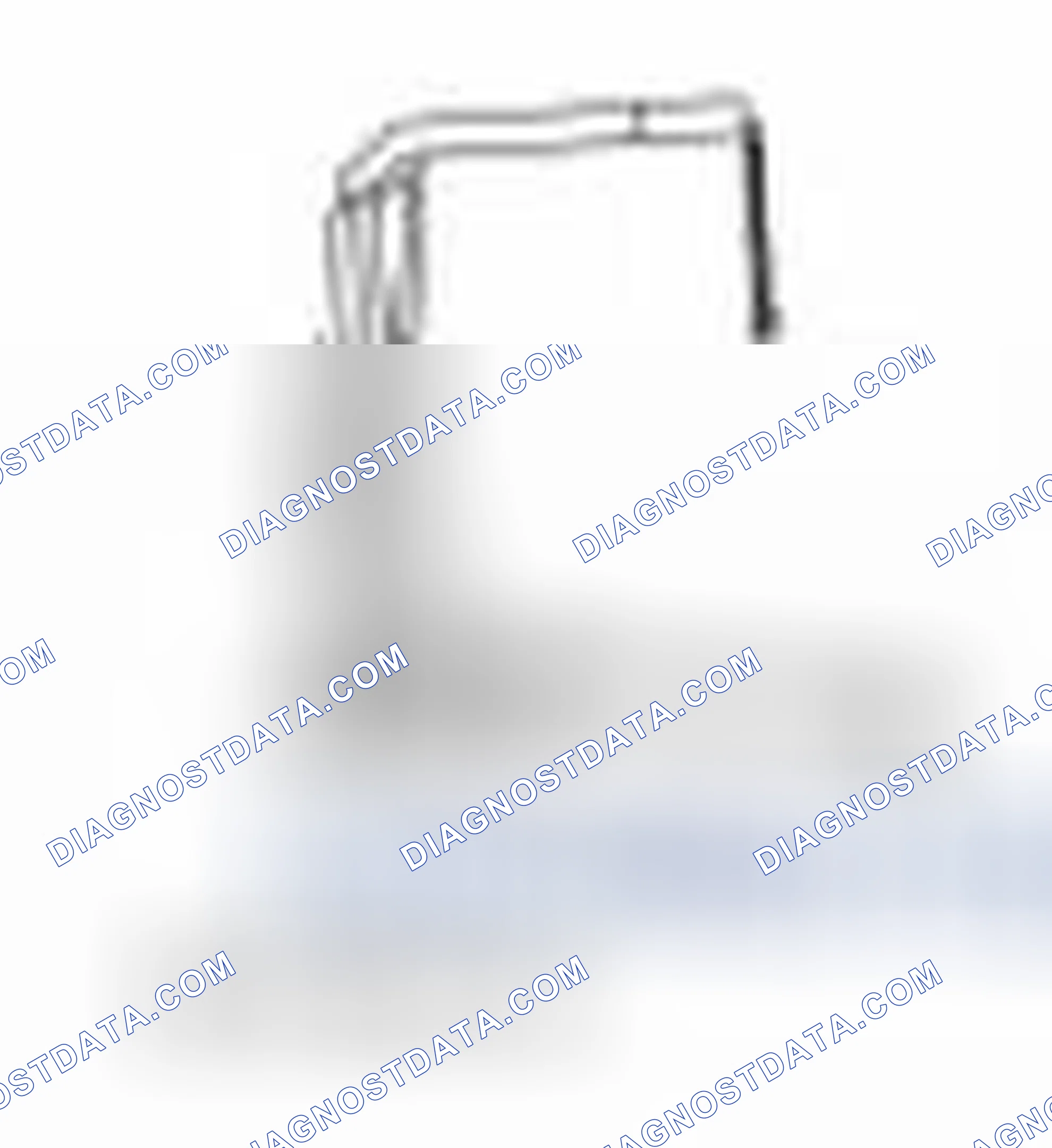 Scheme 94: Special Tool(s)
