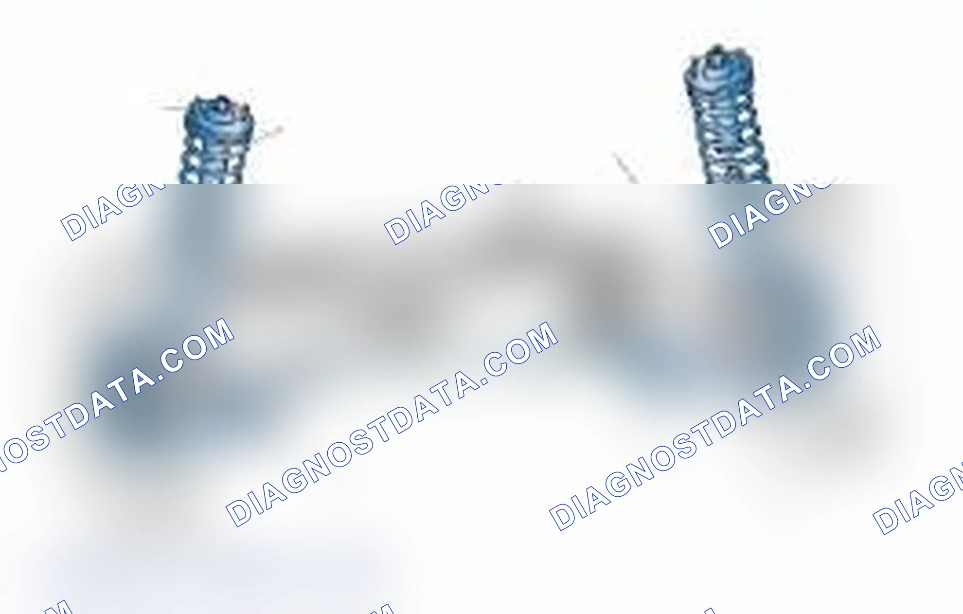 Scheme 25: Typical Front Suspension & Steering Components