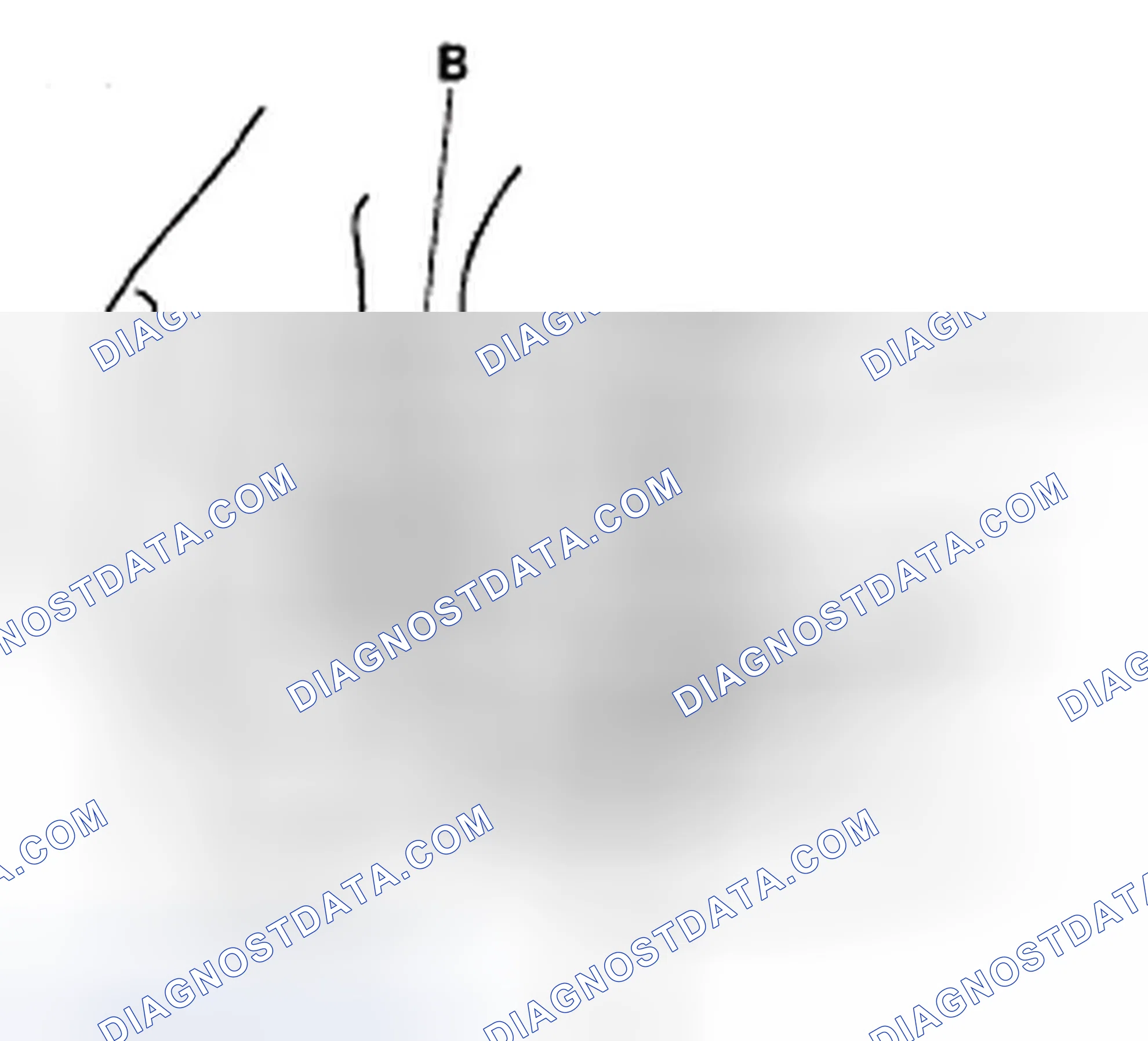Scheme 3: Overrunning Clutch Inspection