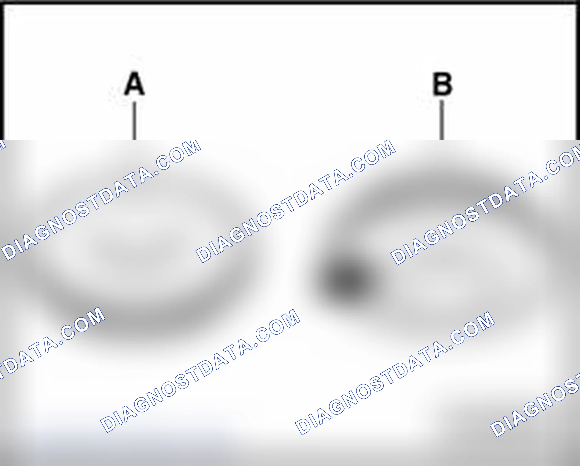 Scheme 870: Installation position of upper and lower halves of subframe bushing