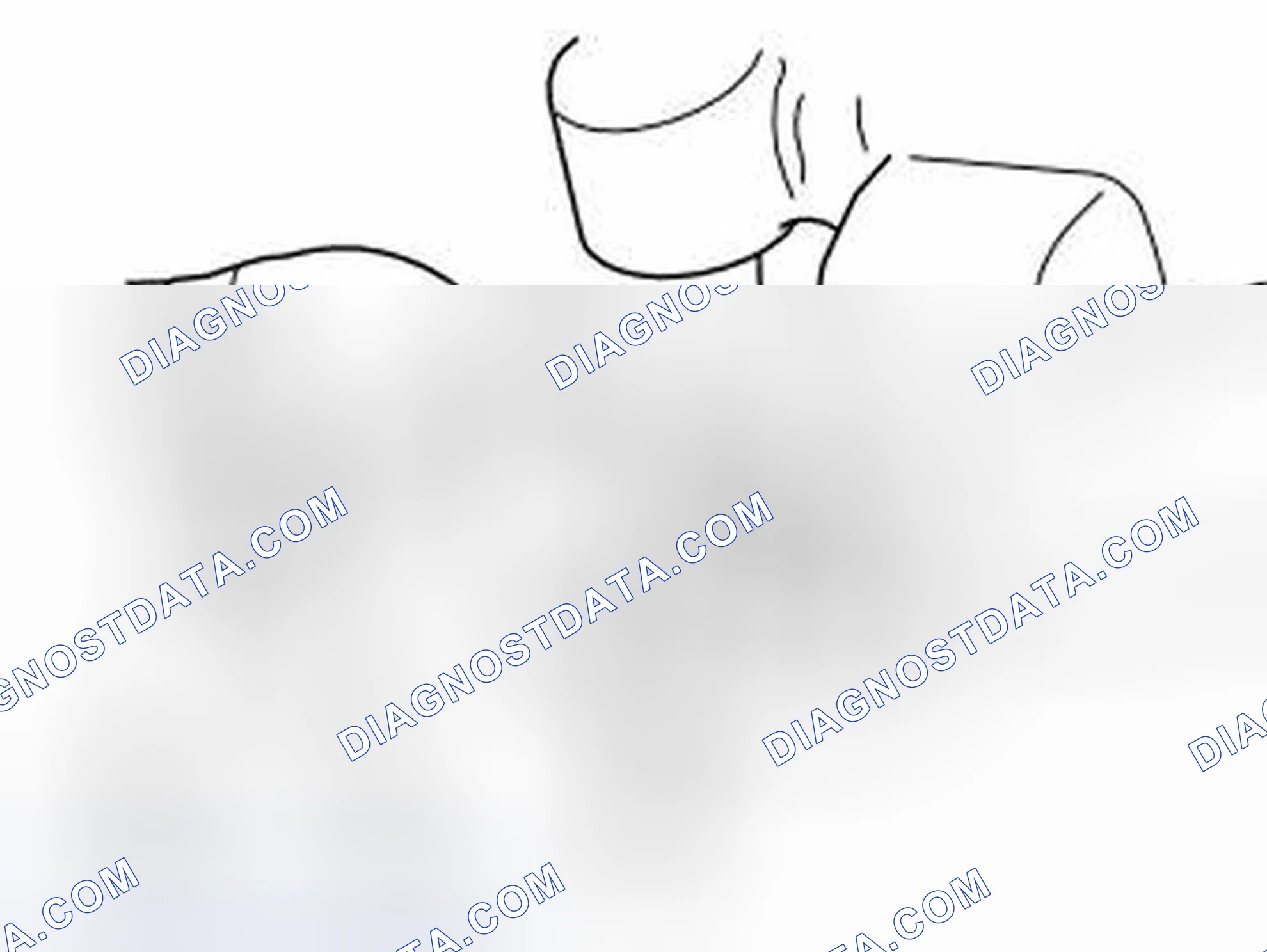 Scheme 100: Cleaning crankcase ventilation
