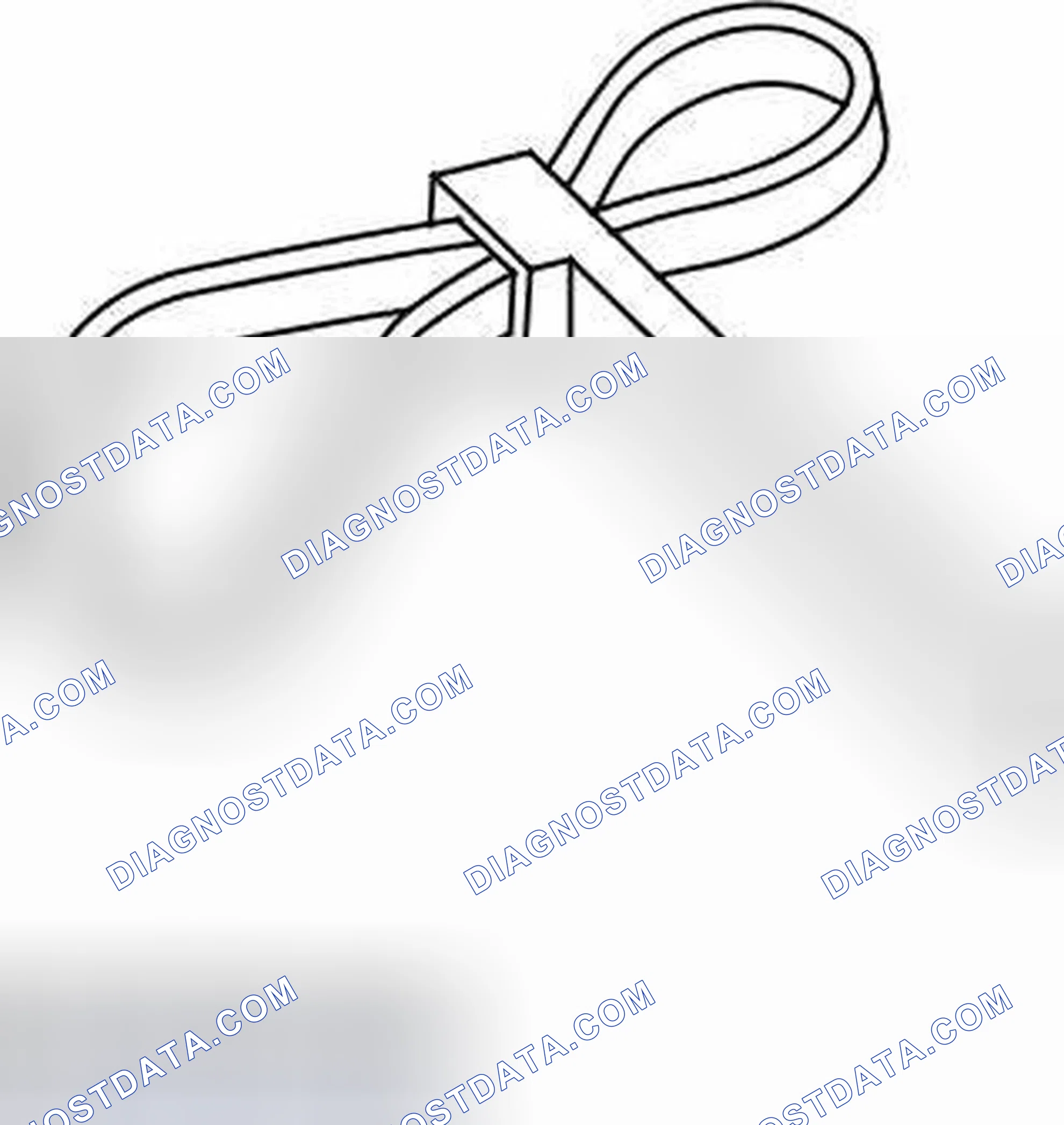 Scheme 296: Crankshaft Pulley - In-Vehicle Procedures